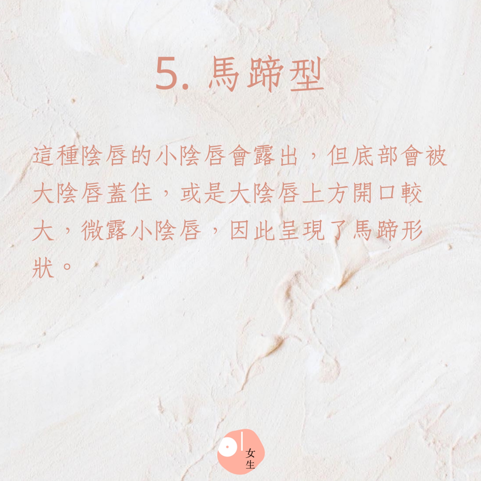 陰道和外陰的5種常見形狀(01製圖) 陰道和外陰的5種常見形狀(01製圖)