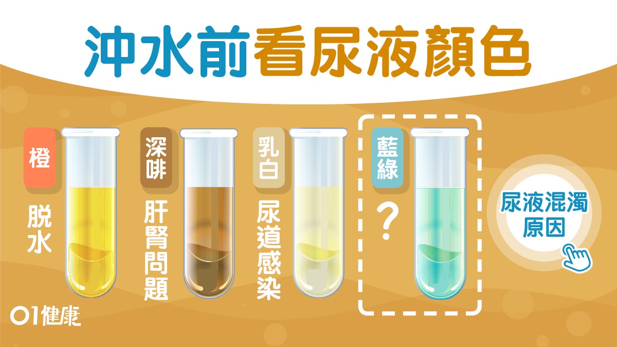 【尿色】尿濁陰道炎腎結石?10種尿色橙色或肝病吃太多維他命C 【尿色】尿濁陰道炎腎結石?10種尿色橙色或肝病吃太多維他命C