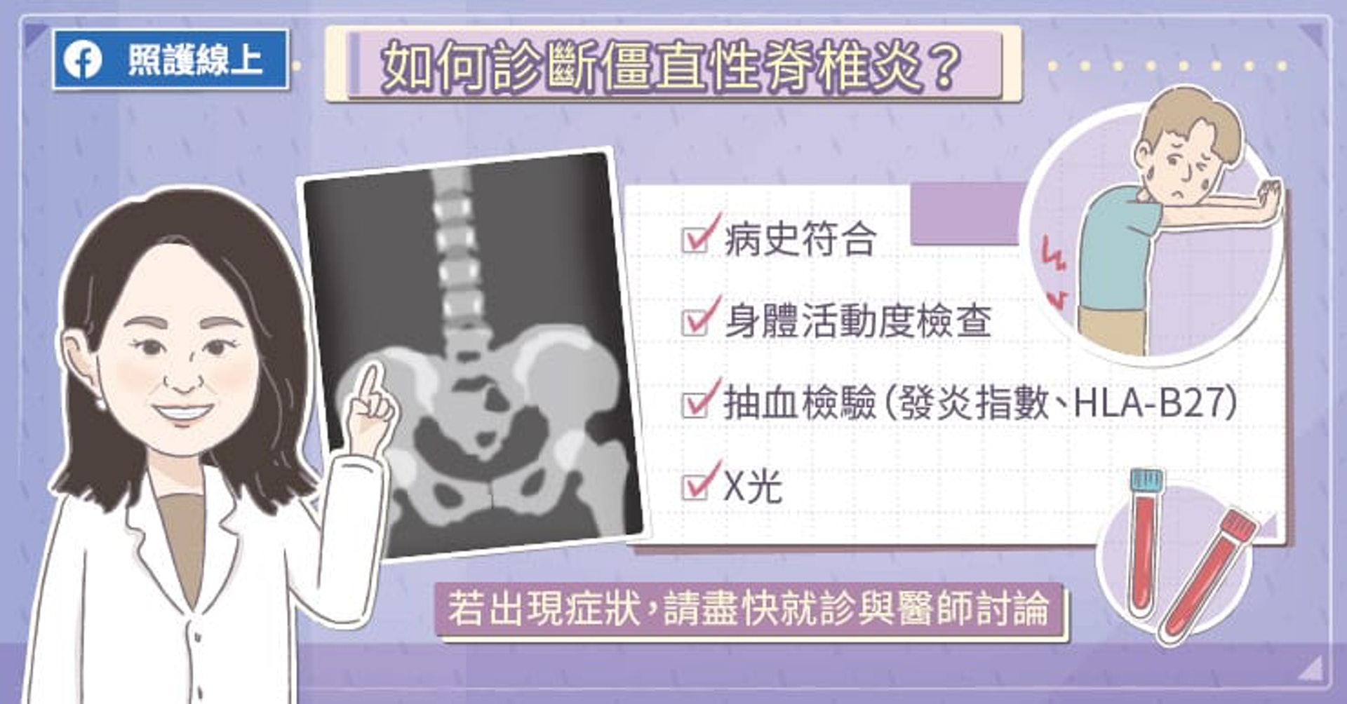 如何診斷僵直性脊椎炎?(照護線上授權使用) 如何診斷僵直性脊椎炎?(照護線上授權使用)