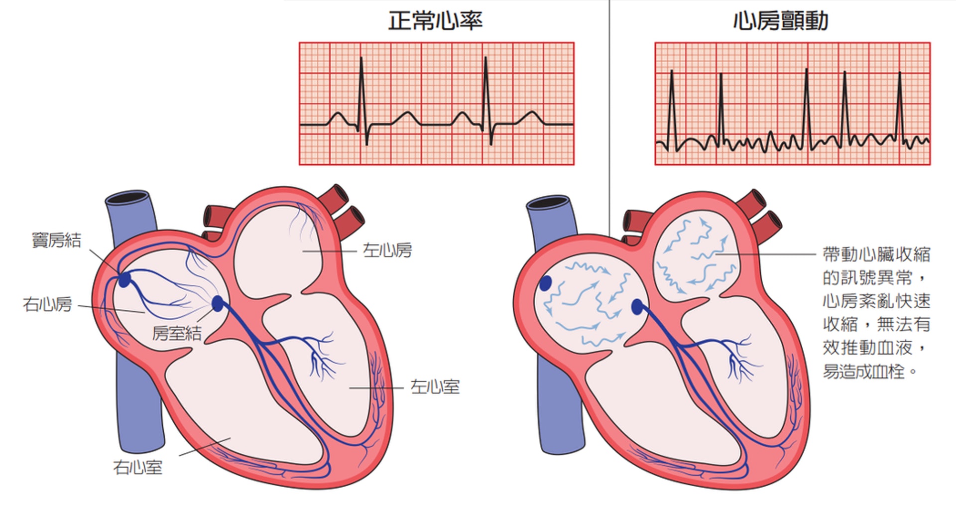 （圖片：health.udn）