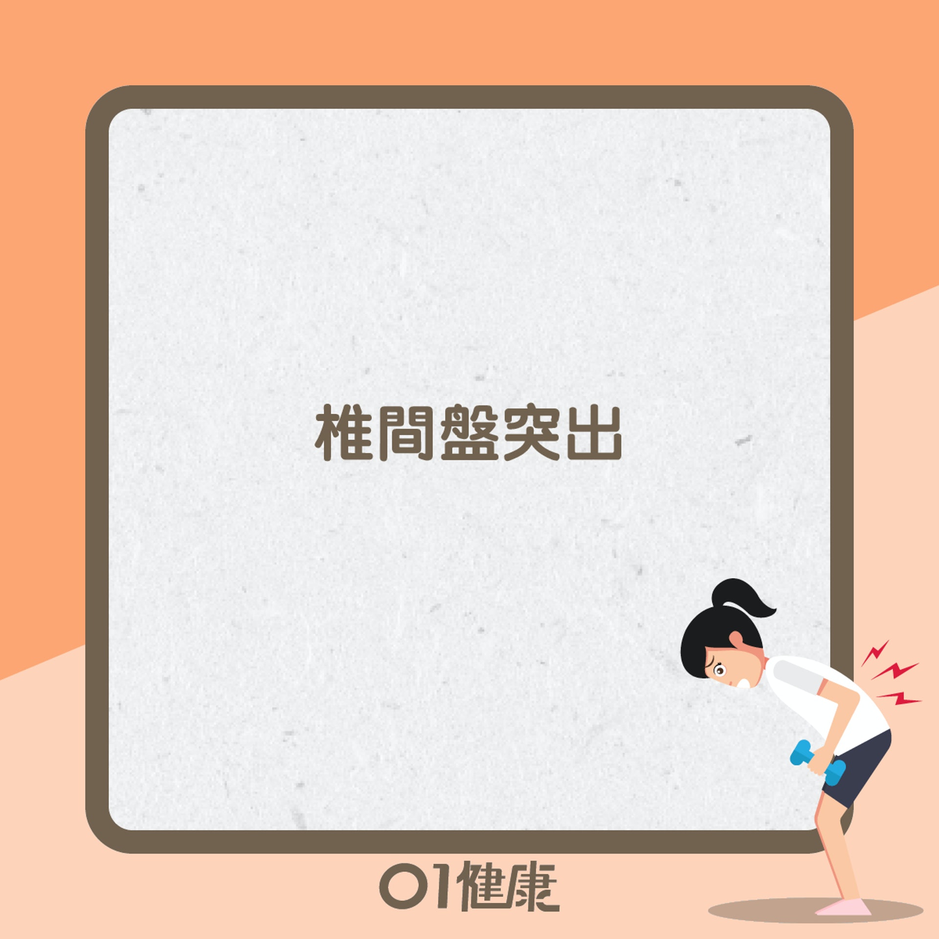 坐骨神經痛常見成因(01製圖) 坐骨神經痛常見成因(01製圖)