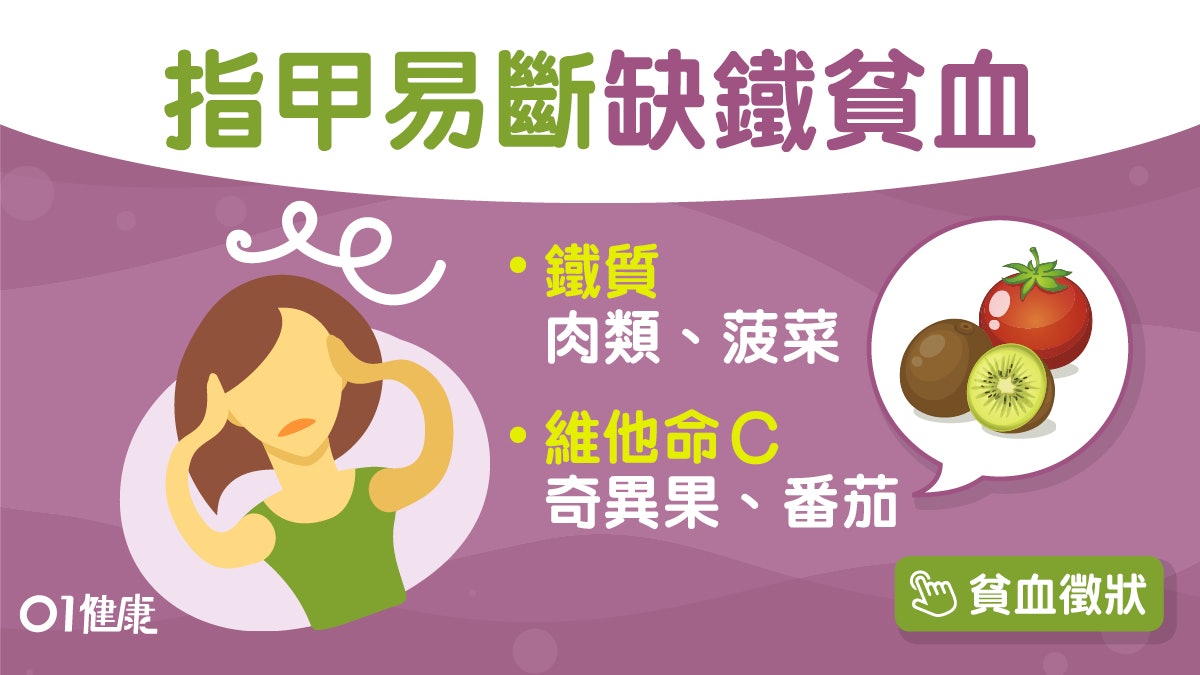 貧血 心跳快愛吃冰塊10症狀或缺鐵性貧血奇異果波菜助鐵質吸收 貧血 心跳快愛吃冰塊10症狀或缺鐵性貧血奇異果波菜助鐵質吸收