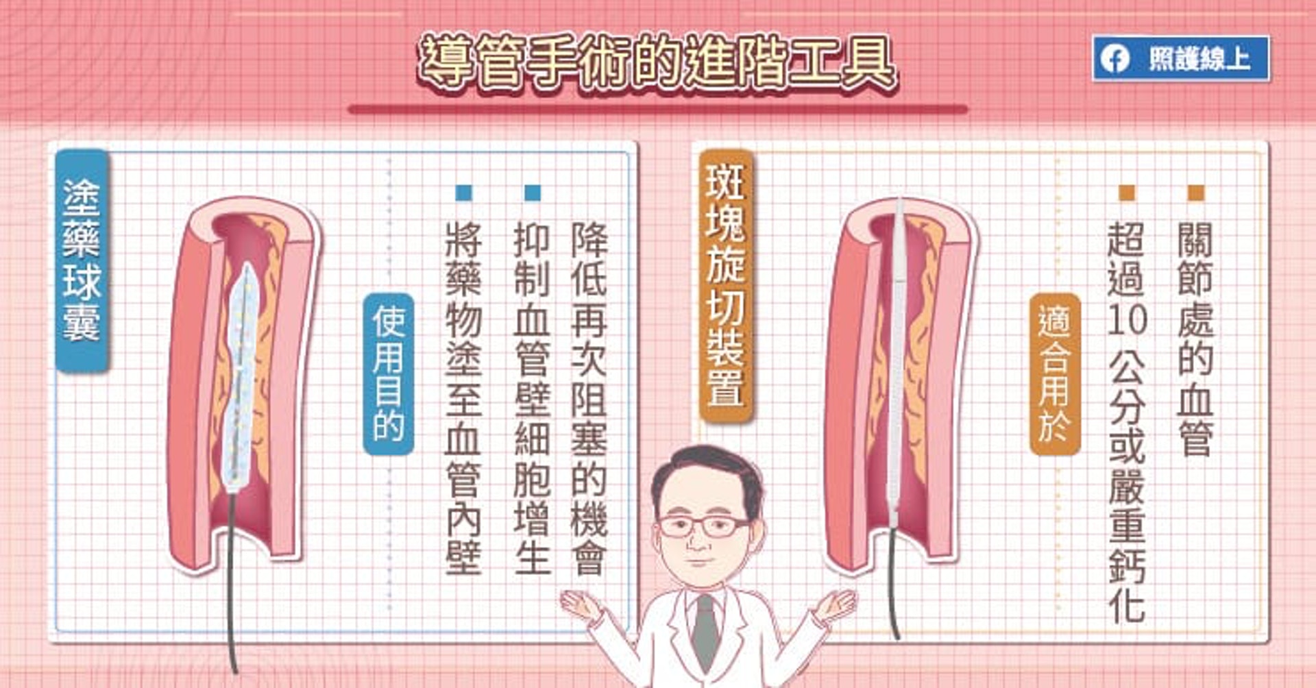 導管手術的進階工具(照護線上授權使用) 導管手術的進階工具(照護線上授權使用)