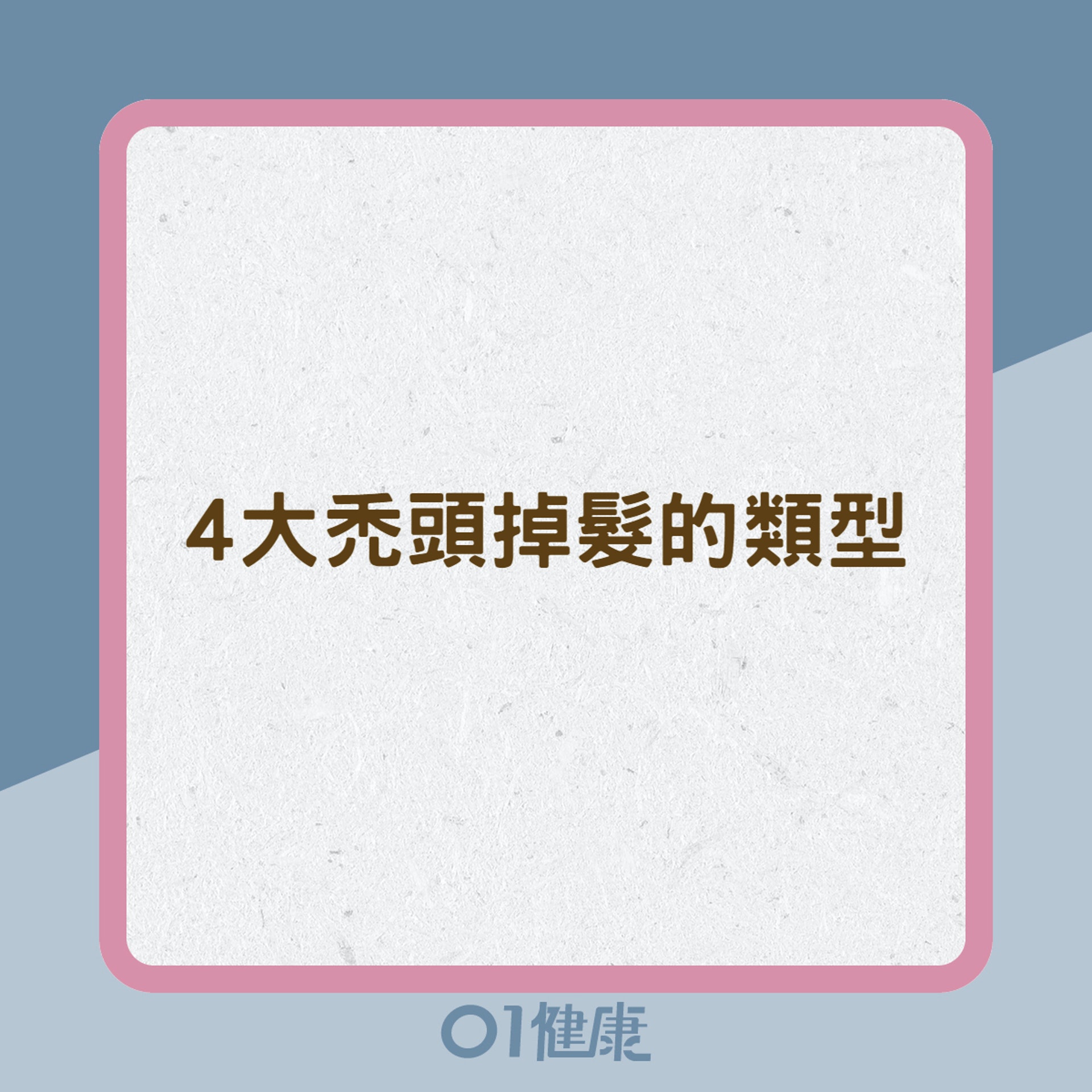 4大禿頭掉髮的類型(01製圖) 4大禿頭掉髮的類型(01製圖)