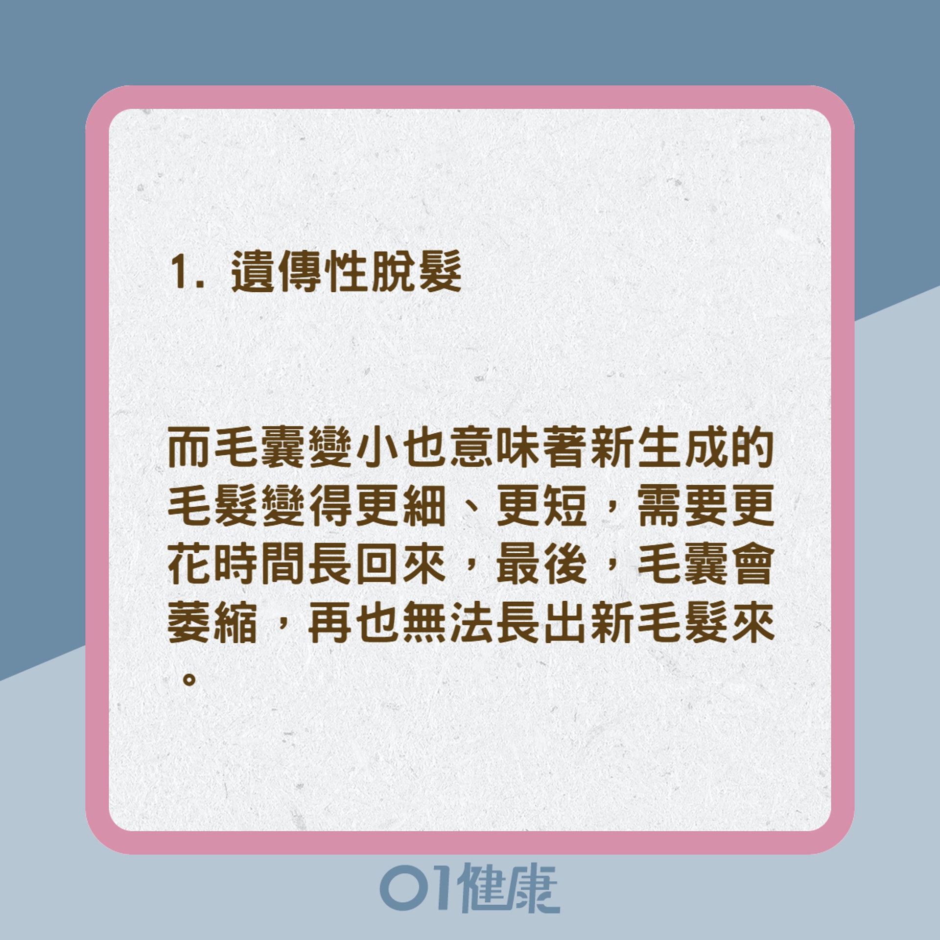 4大禿頭掉髮的類型(01製圖) 4大禿頭掉髮的類型(01製圖)