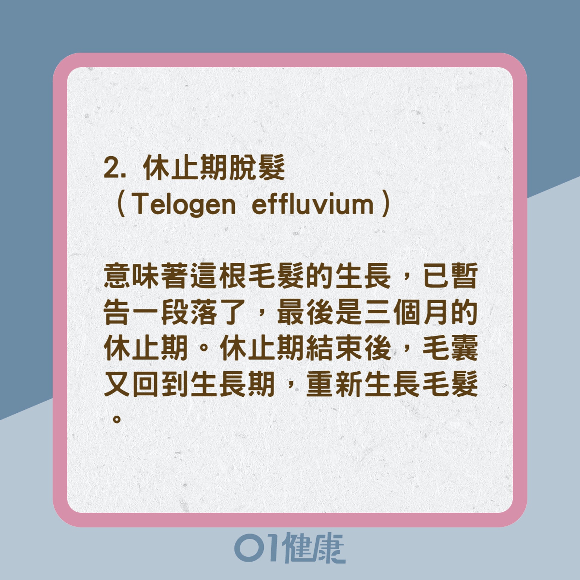4大禿頭掉髮的類型(01製圖) 4大禿頭掉髮的類型(01製圖)