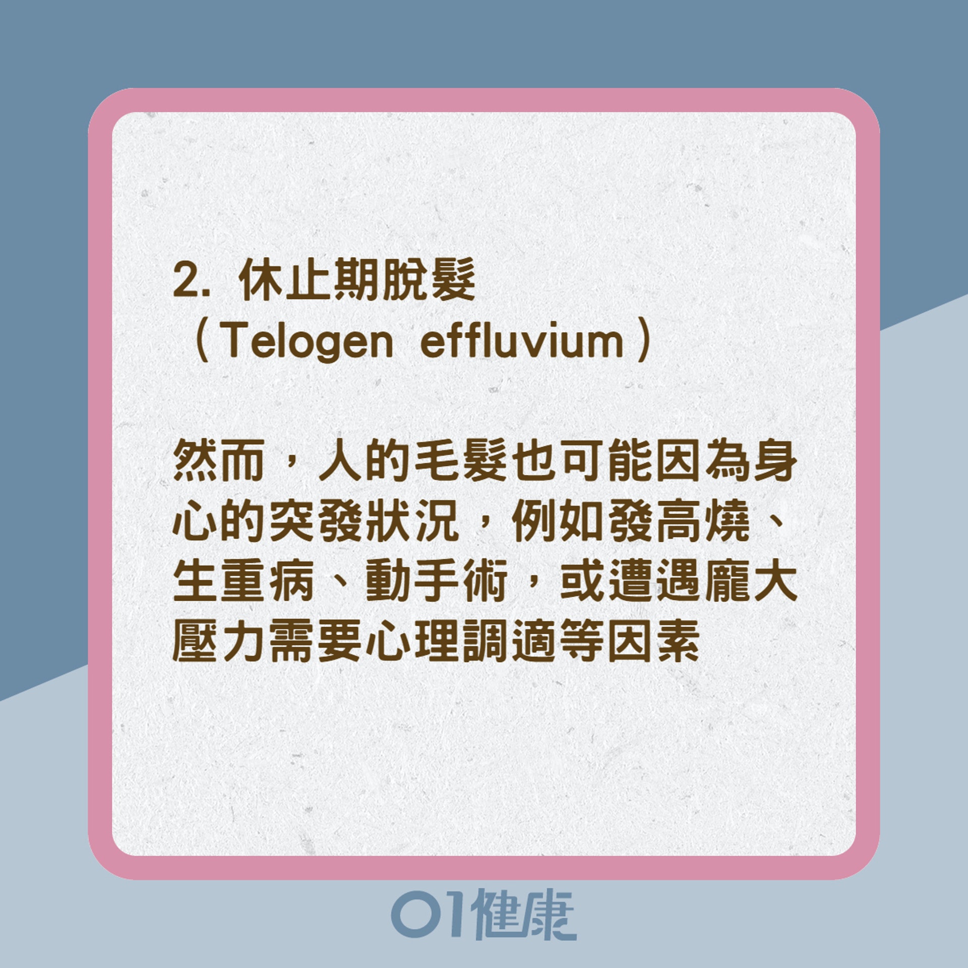 4大禿頭掉髮的類型(01製圖) 4大禿頭掉髮的類型(01製圖)