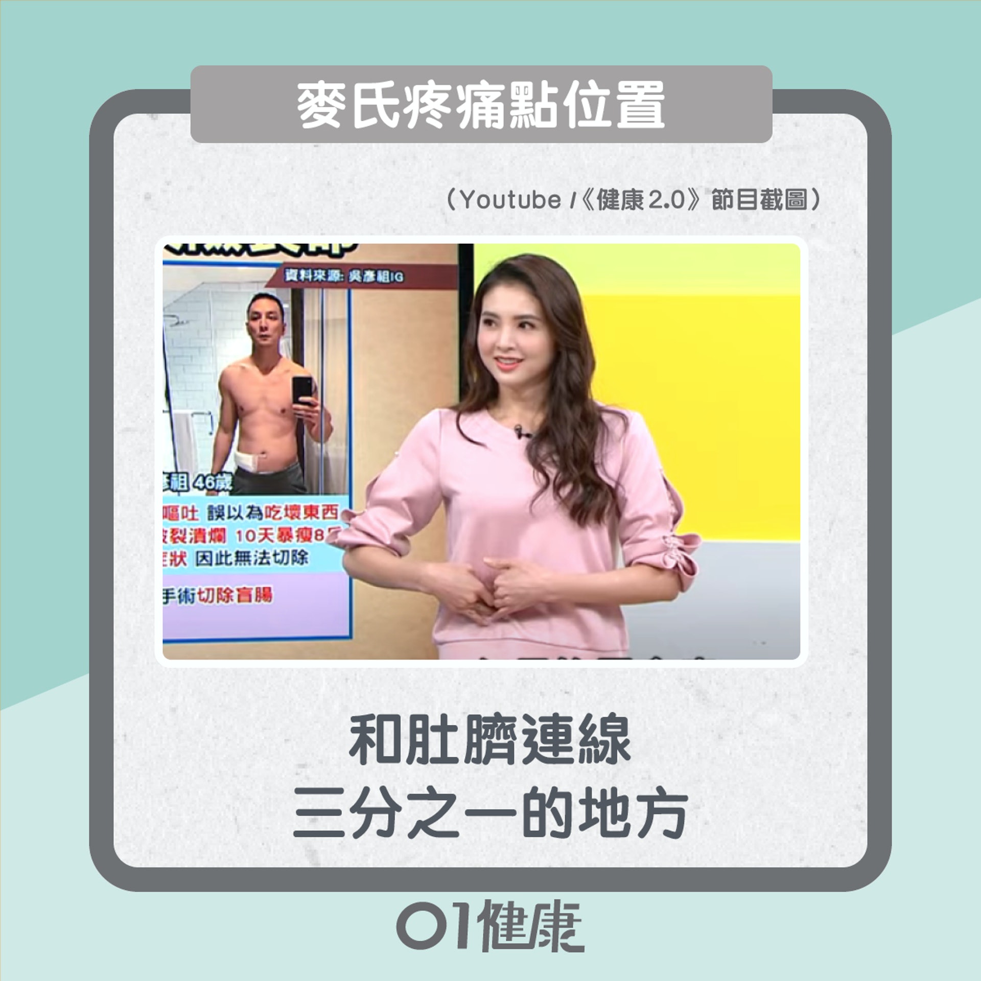 點知係闌尾炎?(01製圖) 點知係闌尾炎?(01製圖)