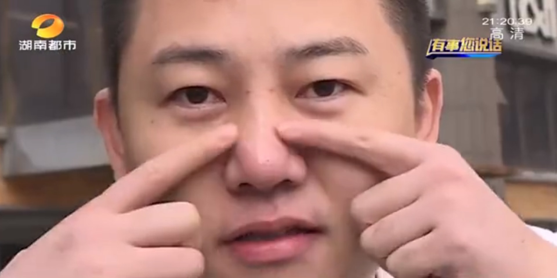想整男星帥哥賈乃亮鼻子點知變蒜頭鼻酒吧男索償 我靠面吃飯 香港01 熱爆話題 想整男星帥哥賈乃亮鼻子點知變蒜頭鼻酒吧男索償 我靠面吃飯 香港01 熱爆話題