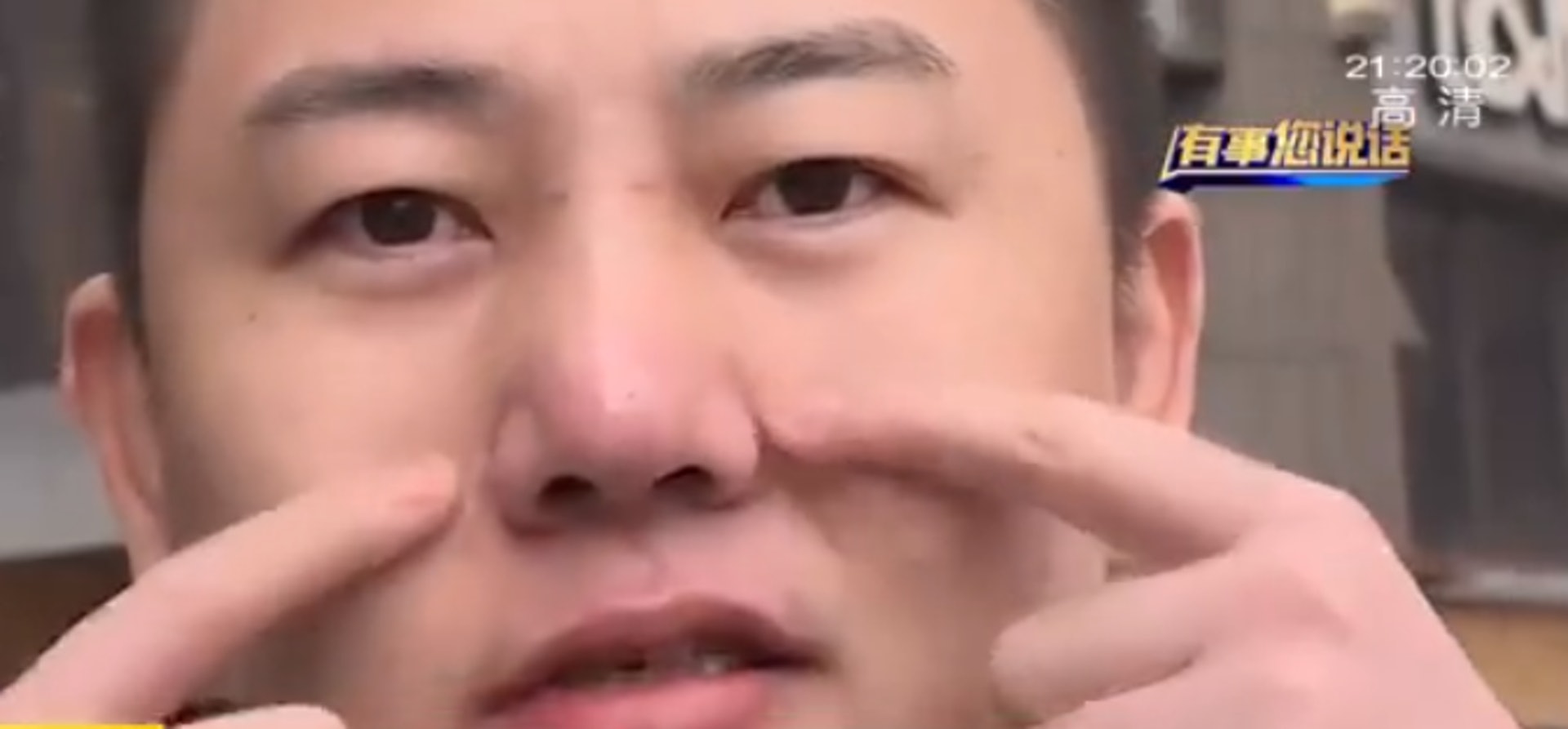 想整男星帥哥賈乃亮鼻子點知變蒜頭鼻酒吧男索償 我靠面吃飯 想整男星帥哥賈乃亮鼻子點知變蒜頭鼻酒吧男索償 我靠面吃飯