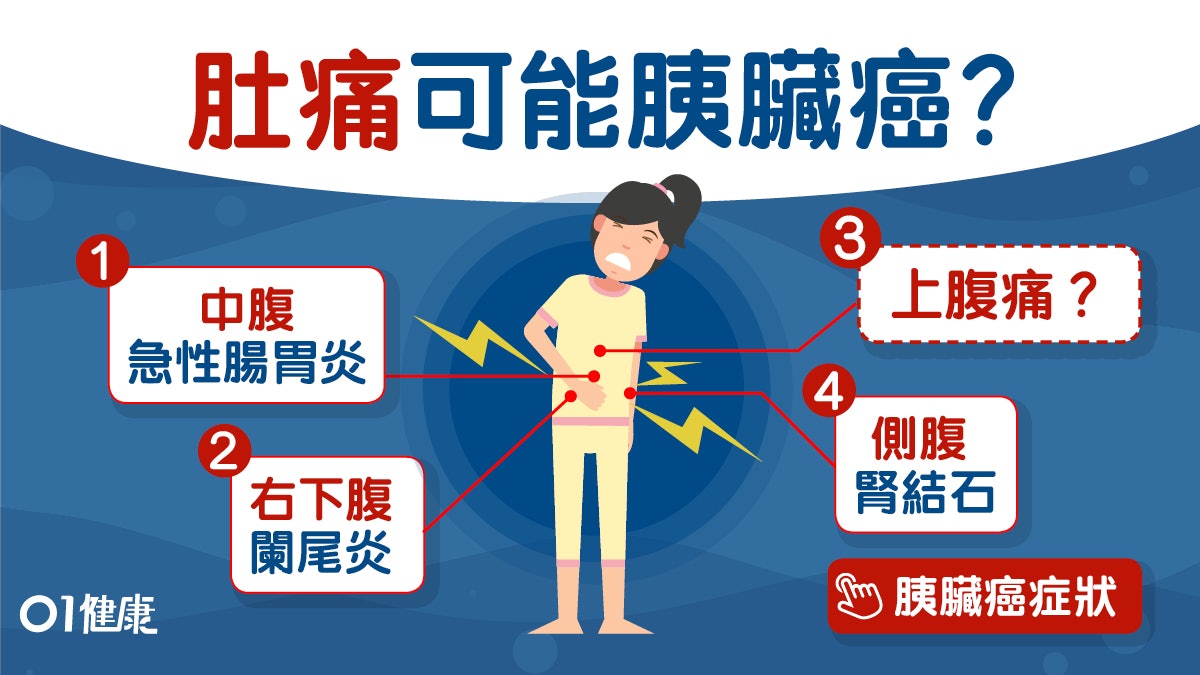 肚痛 側腹痛腎結石上腹痛胰臓癌 記住5個位置肚痛可大可小 香港01 健康