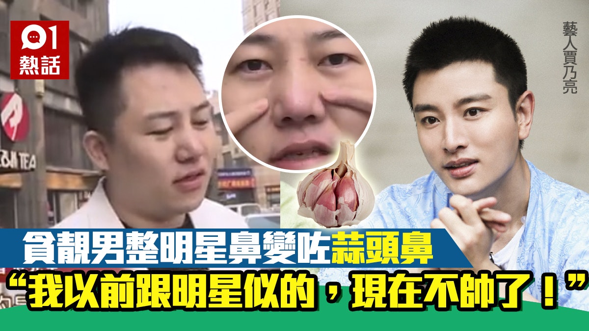 想整男星帥哥賈乃亮鼻子點知變蒜頭鼻酒吧男索償 我靠面吃飯 香港01 熱爆話題 想整男星帥哥賈乃亮鼻子點知變蒜頭鼻酒吧男索償 我靠面吃飯 香港01 熱爆話題