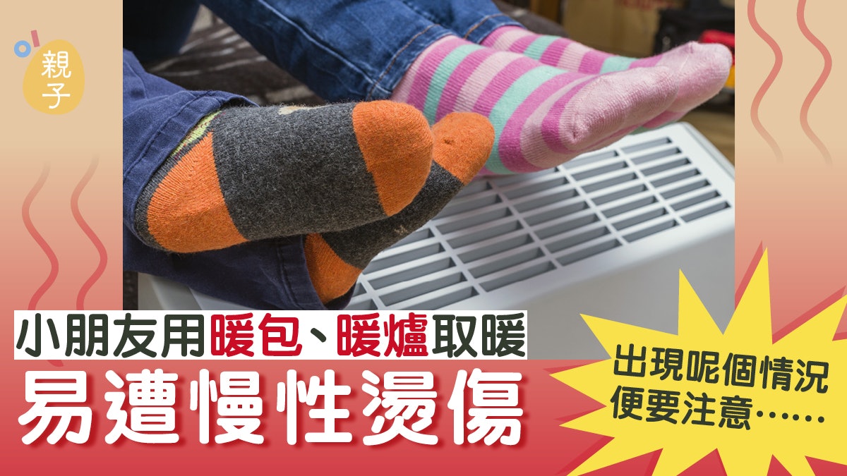 孩子愛用暖包、暖爐取暖易遭慢性燙傷 現火逼性紅斑冰敷療效微弱 孩子愛用暖包、暖爐取暖易遭慢性燙傷 現火逼性紅斑冰敷療效微弱
