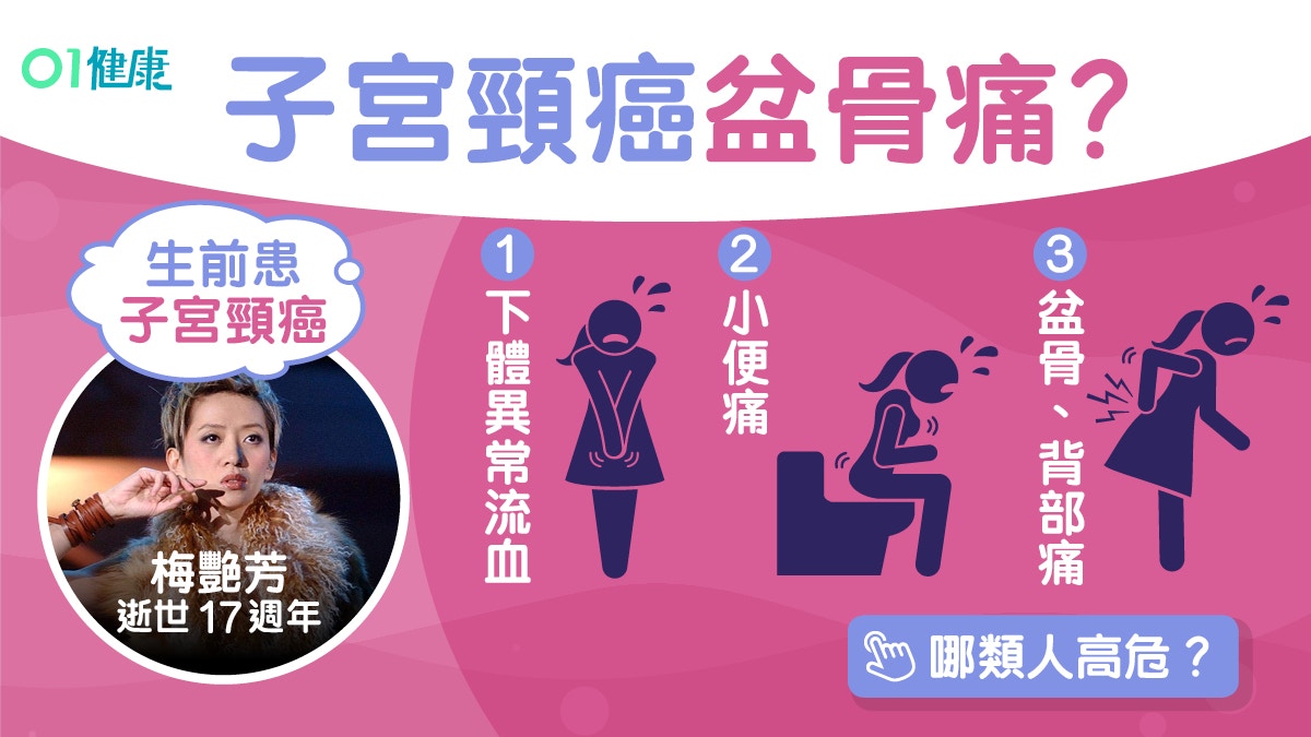 【梅艷芳逝世17週年】子宮頸癌病徵盆骨痛背痛　家族史高危6須知