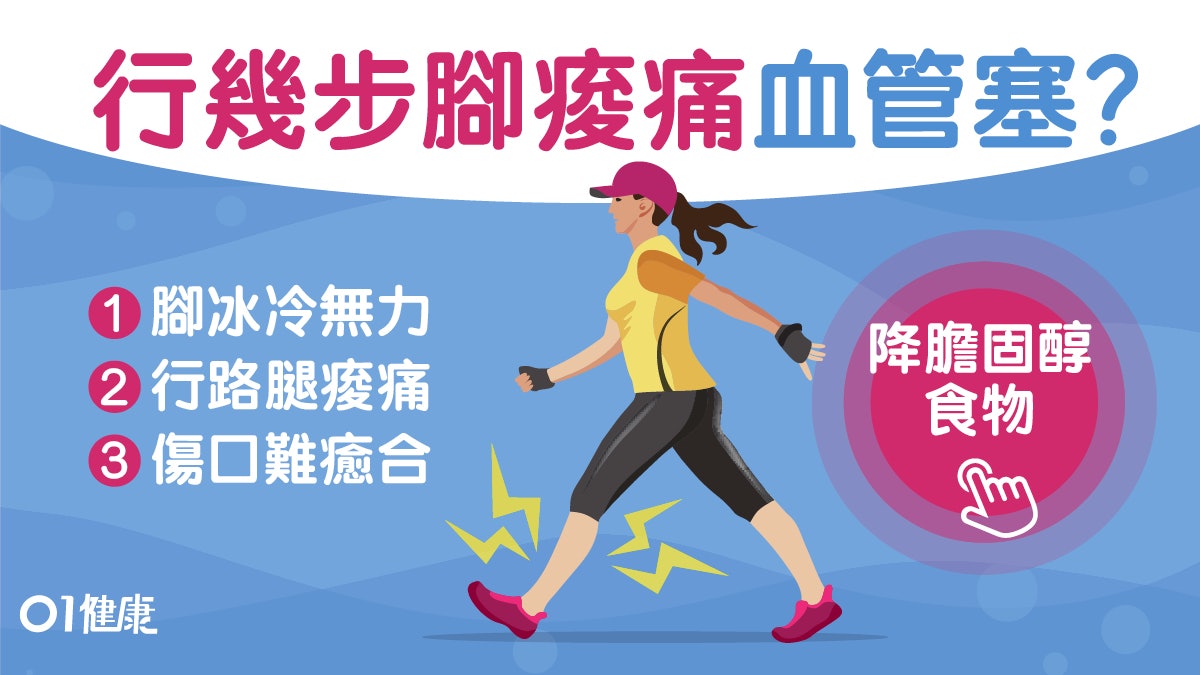 血管阻塞|腳凍麻痺無力8大症狀 下肢動脈阻塞嚴重或需截肢? 血管阻塞|腳凍麻痺無力8大症狀 下肢動脈阻塞嚴重或需截肢?