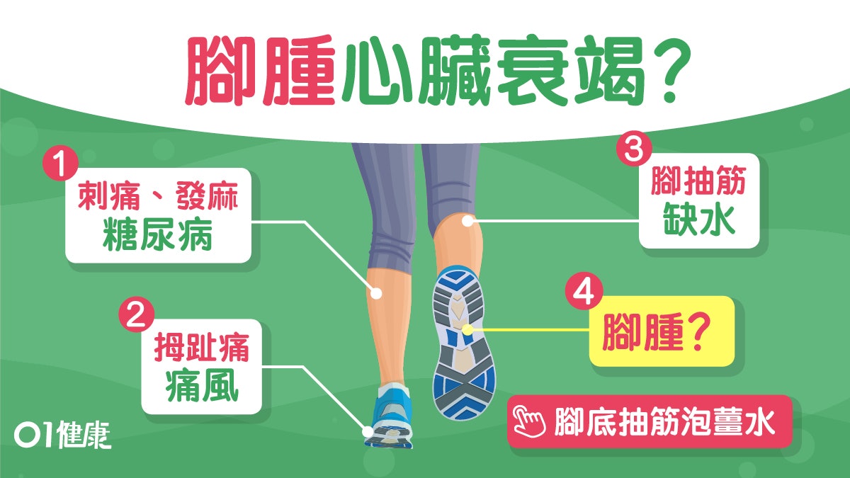 腳痛 腳踭腫腎有事腳趾公腫痛或痛風 8種腳患暗藏疾病危機 香港01 健康 腳痛 腳踭腫腎有事腳趾公腫痛或痛風 8種腳患暗藏疾病危機 香港01 健康