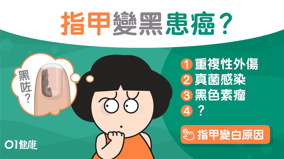 腳趾甲變黑|皮膚癌真菌感染4大原因 甲油阻趾甲呼吸點揀鞋好? 腳趾甲變黑|皮膚癌真菌感染4大原因 甲油阻趾甲呼吸點揀鞋好?