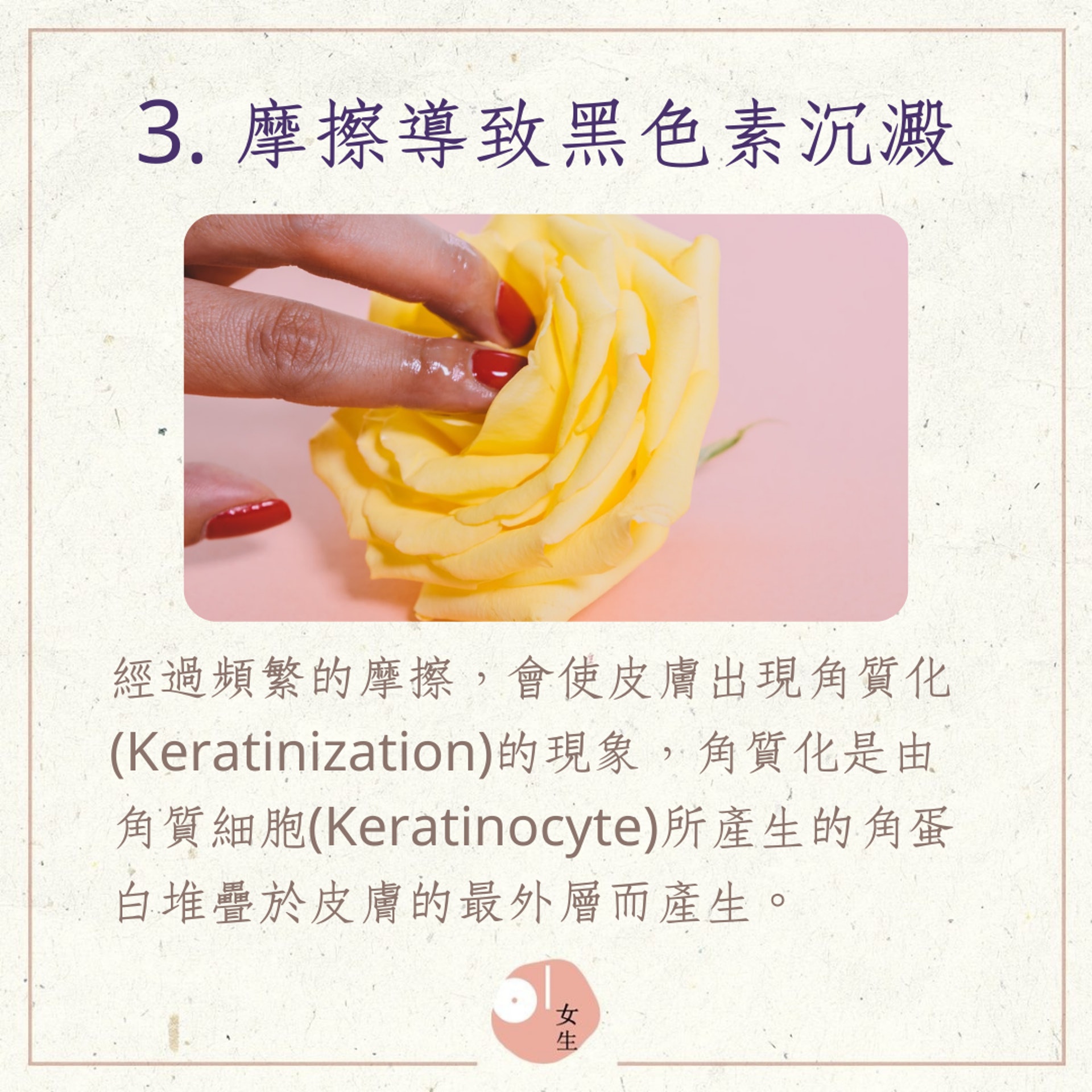 3種影響私密處顏色的主要原因(01製圖,Malvestida Magazine/Unsplash) 3種影響私密處顏色的主要原因(01製圖,Malvestida Magazine/Unsplash)
