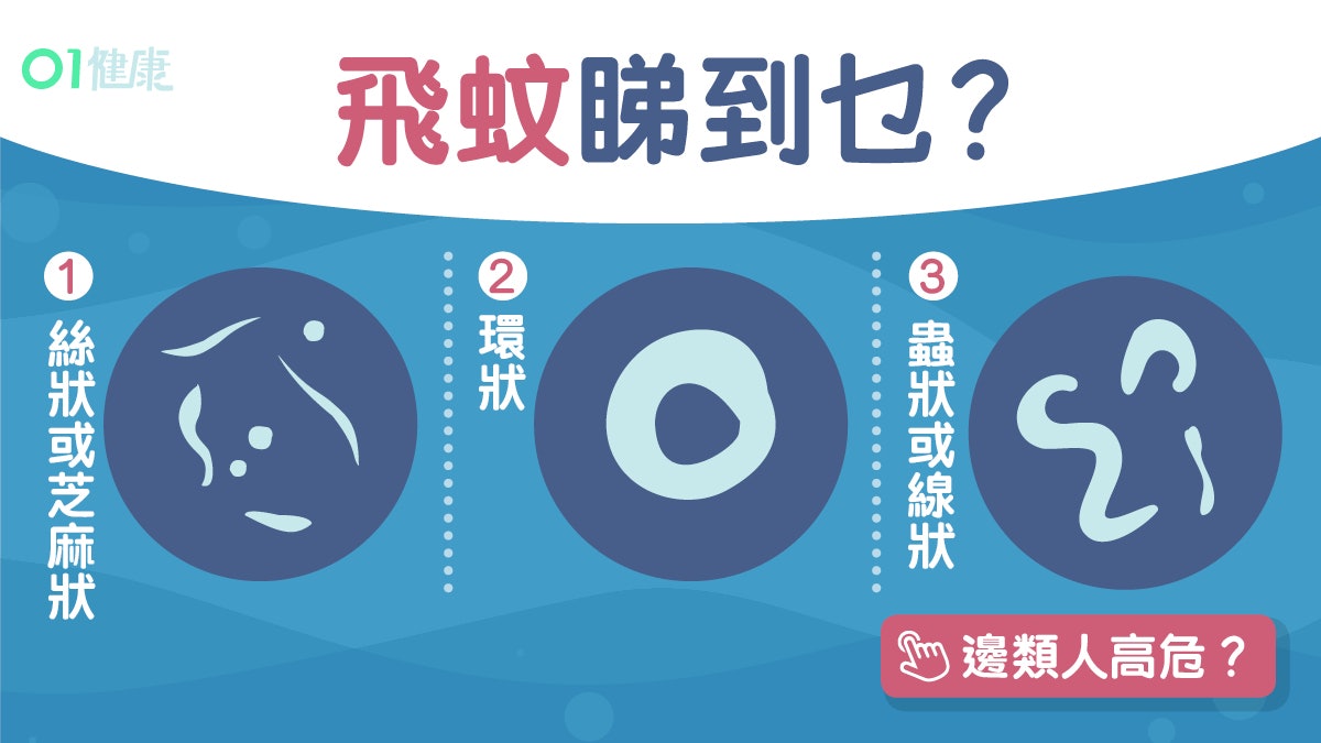 飛蚊症|糖尿眼高血壓大近視高危唔夠瞓都有關?暗藏6種疾病警號 飛蚊症|糖尿眼高血壓大近視高危唔夠瞓都有關?暗藏6種疾病警號