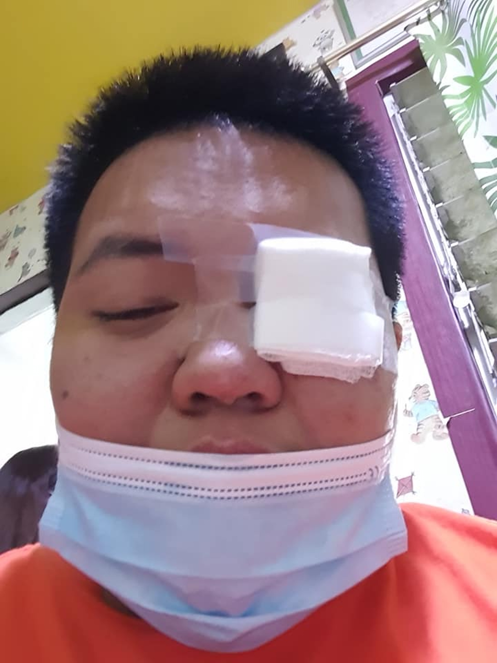 主人的眼角膜被撞掉了一層!(Facebook@Woofing) 主人的眼角膜被撞掉了一層!(Facebook@Woofing)