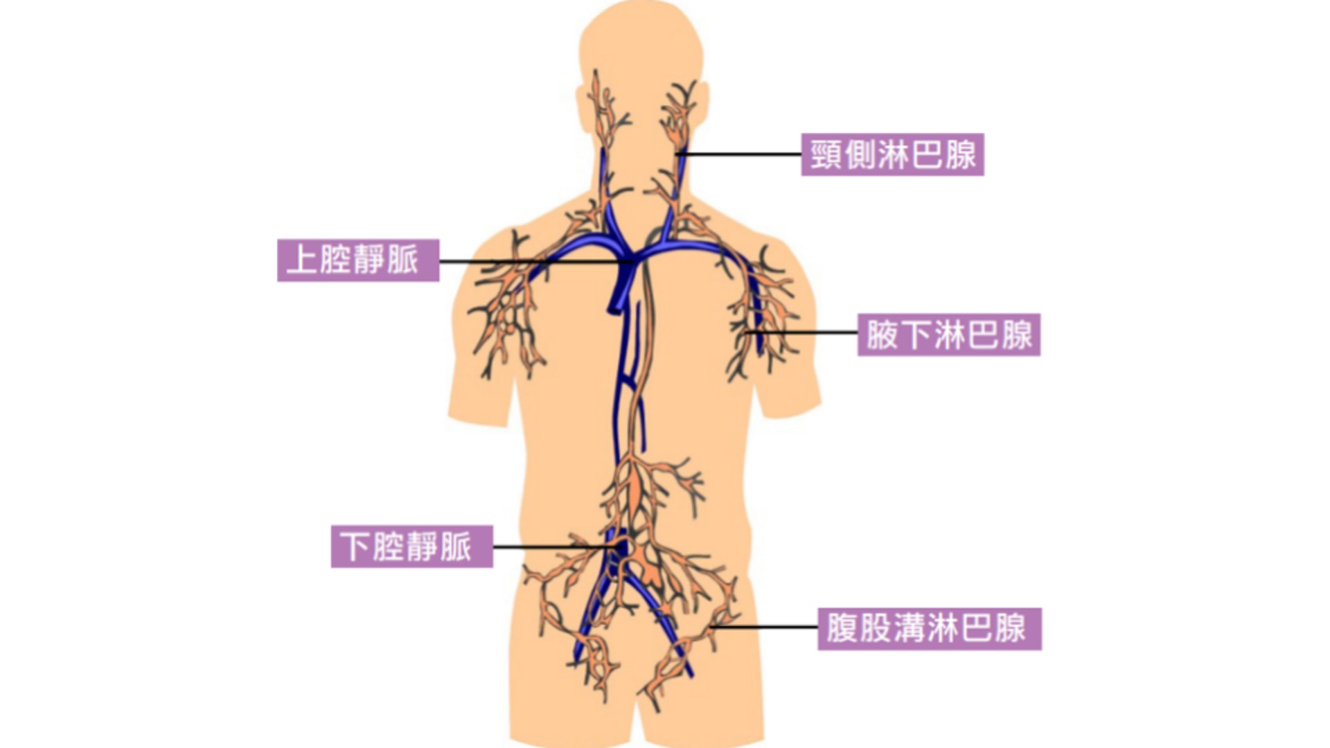 林建名病逝 淋巴癌非長者獨有及早察覺六大特徵提高治癒率 林建名病逝 淋巴癌非長者獨有及早察覺六大特徵提高治癒率