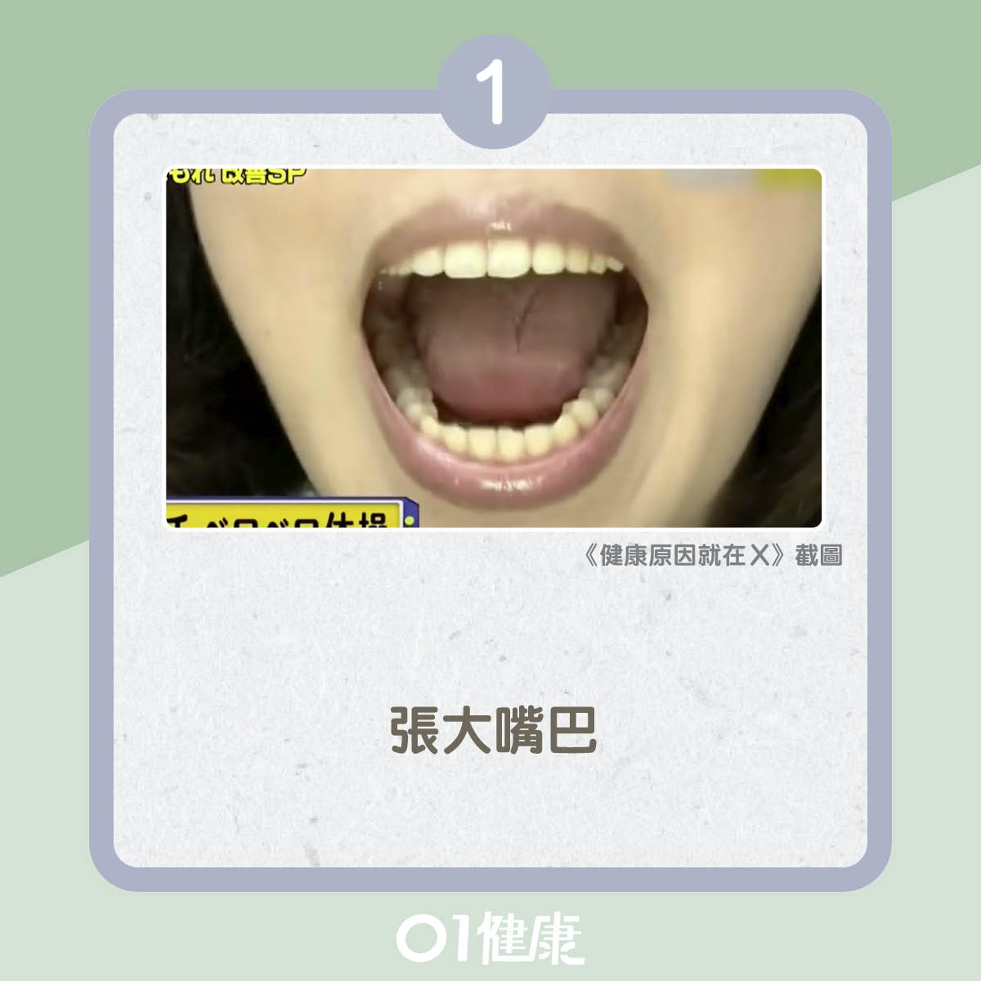 口部健康操(01製圖) 口部健康操(01製圖)