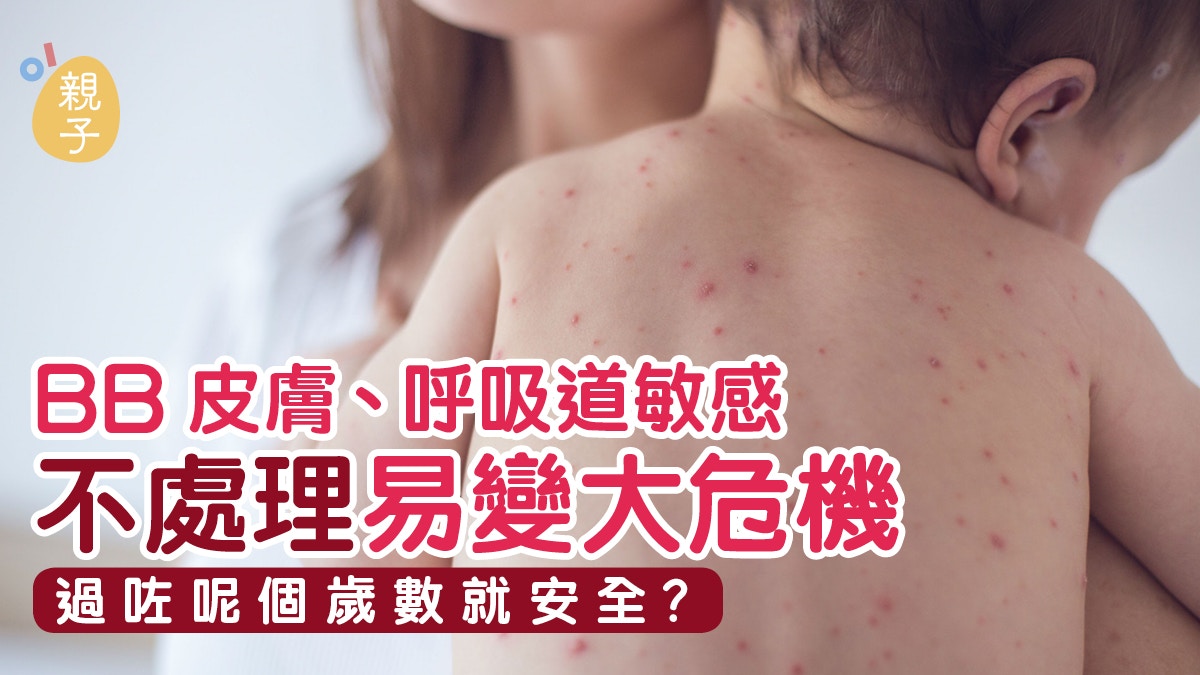子女皮膚、呼吸道敏感「咁就一世」? 了解2大過敏症關鍵轉捩點 子女皮膚、呼吸道敏感「咁就一世」? 了解2大過敏症關鍵轉捩點