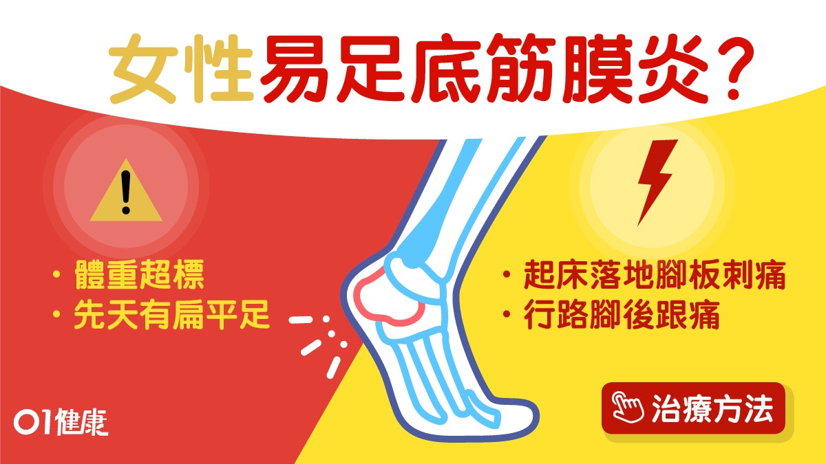 足底筋膜炎|肥胖扁平足6高危因素 加速復原6招足弓鞋墊有用嗎? 足底筋膜炎|肥胖扁平足6高危因素 加速復原6招足弓鞋墊有用嗎?