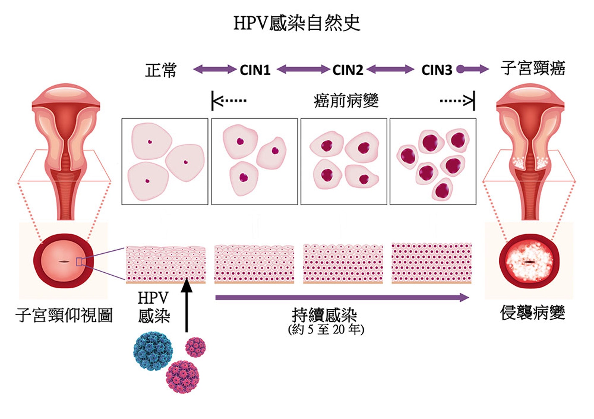 （圖片：HPVSelfSampling）