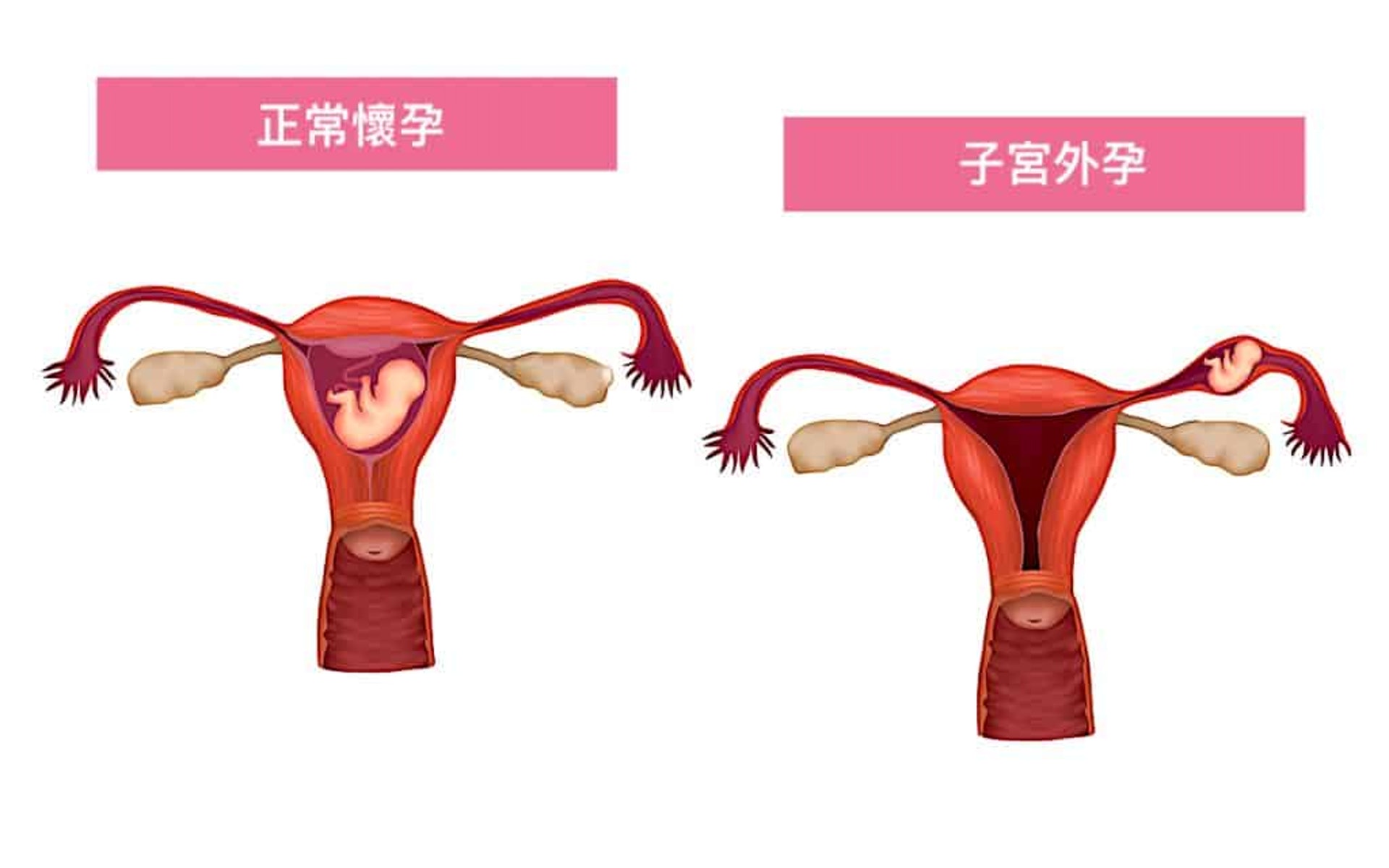 (圖片:helloyishi) (圖片:helloyishi)