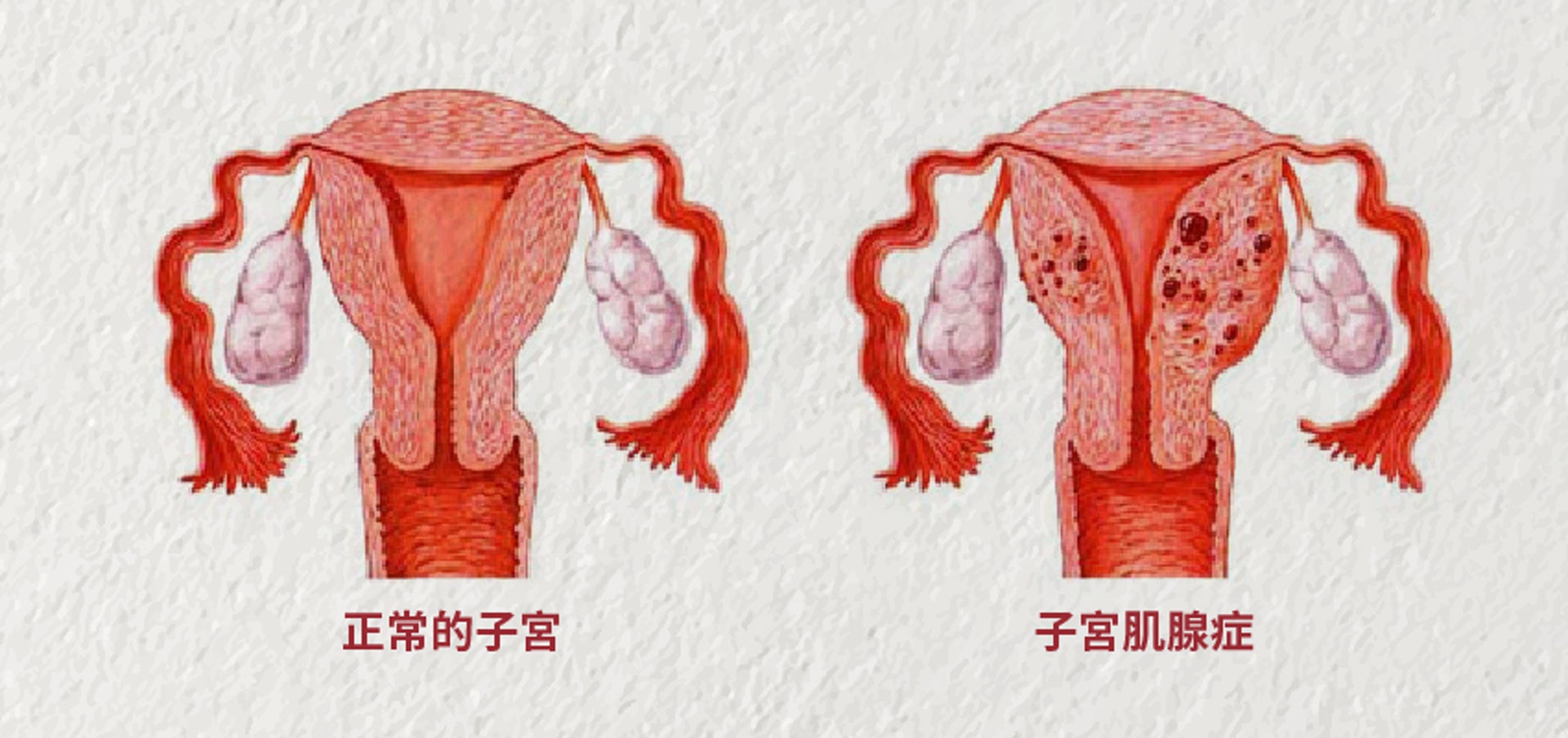 (圖片:health.tvbs) (圖片:health.tvbs)