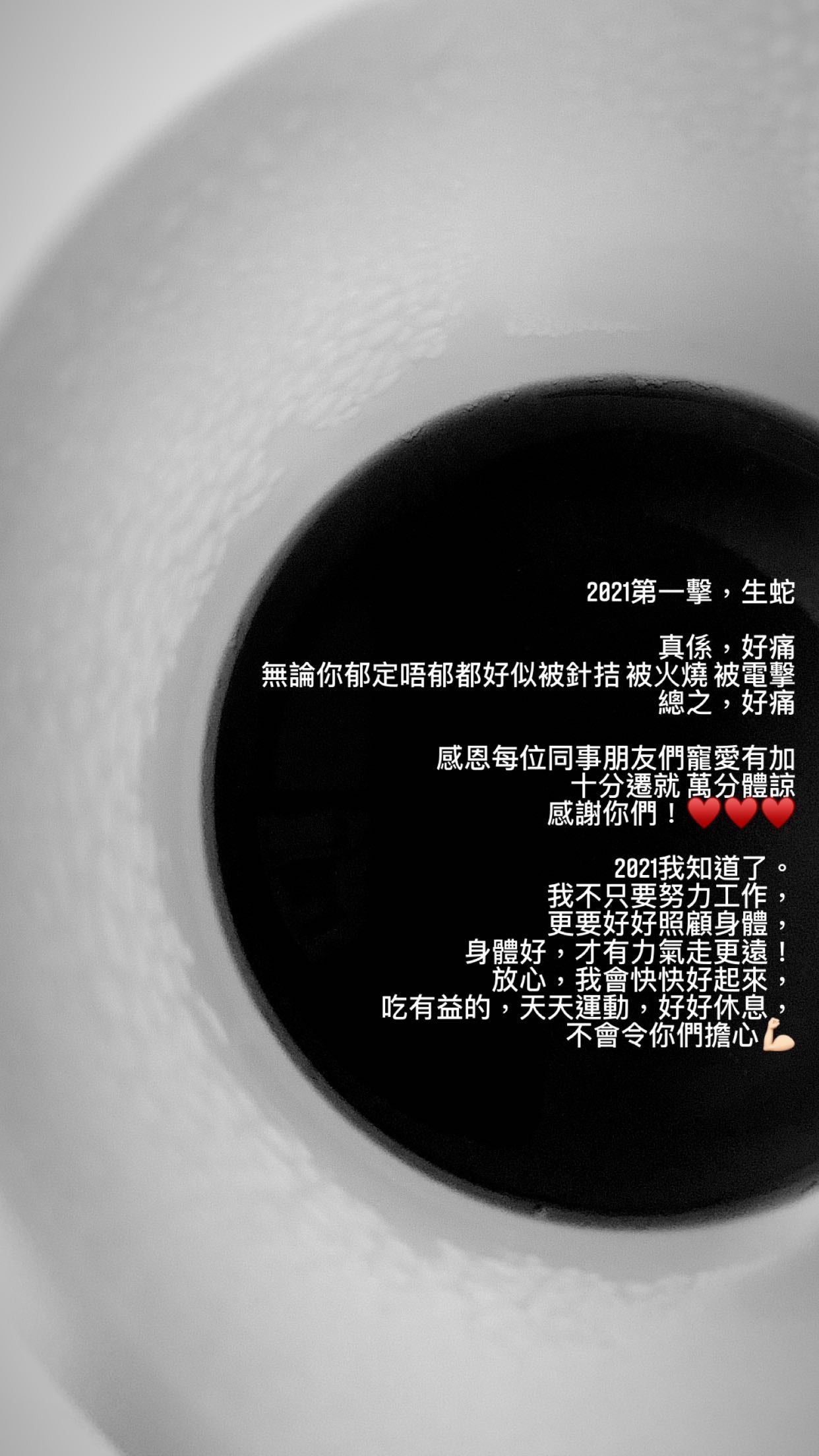 劉佩玥不幸患上俗稱「生蛇」的帶狀疱疹。（IG@arryuu）