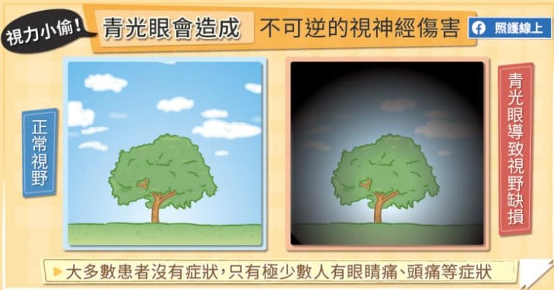 正常視野和青光眼導致視野缺損(照護線上授權使用) 正常視野和青光眼導致視野缺損(照護線上授權使用)