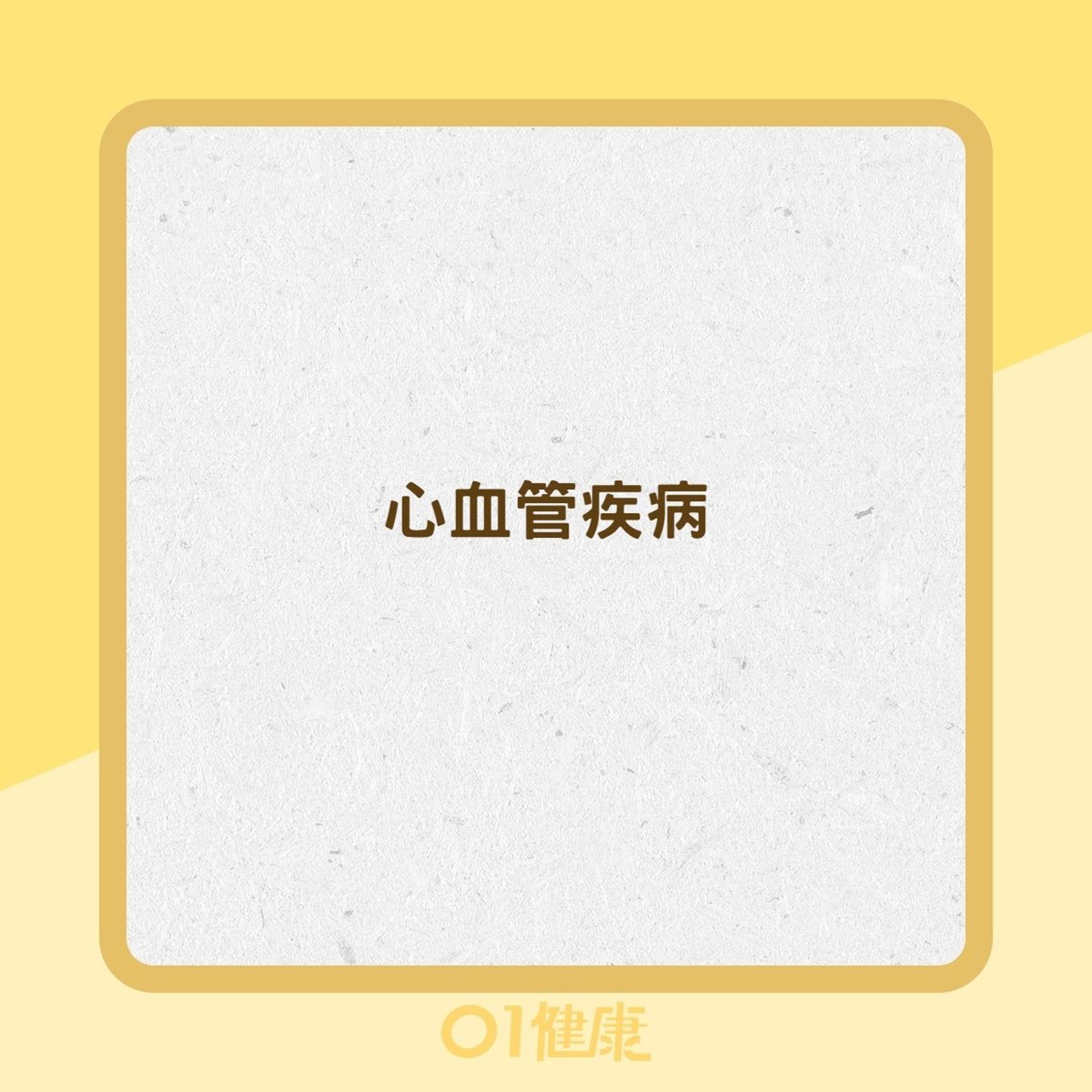 青光眼高危險族群(01製圖) 青光眼高危險族群(01製圖)