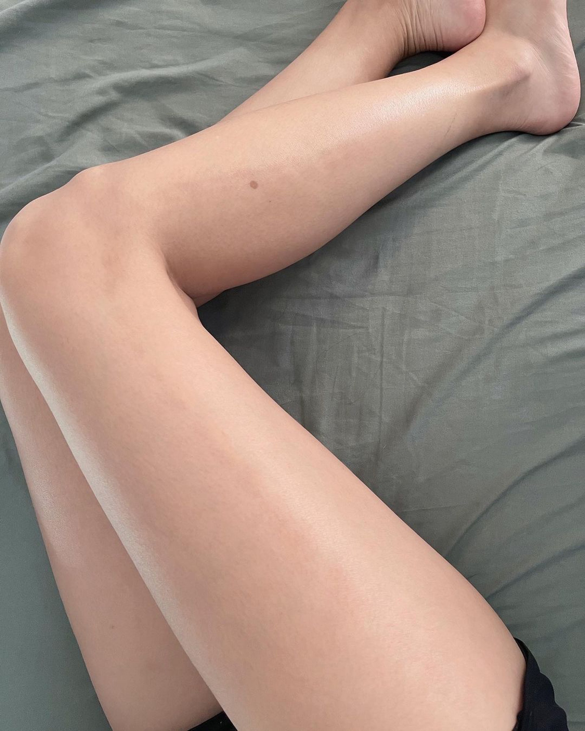 右腿亦有黑痕。(朱智賢Instagram) 右腿亦有黑痕。(朱智賢Instagram)