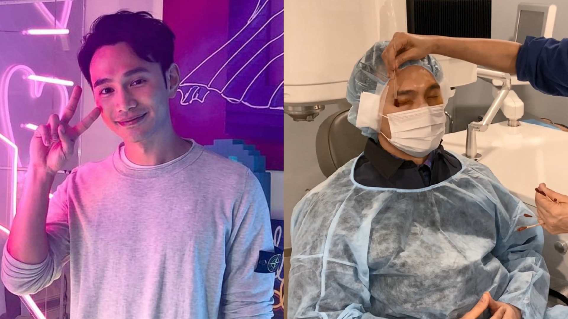 王梓軒做矯視手術踢走大近視 過程膽戰心驚:似拍迷幻MV! 王梓軒做矯視手術踢走大近視 過程膽戰心驚:似拍迷幻MV!