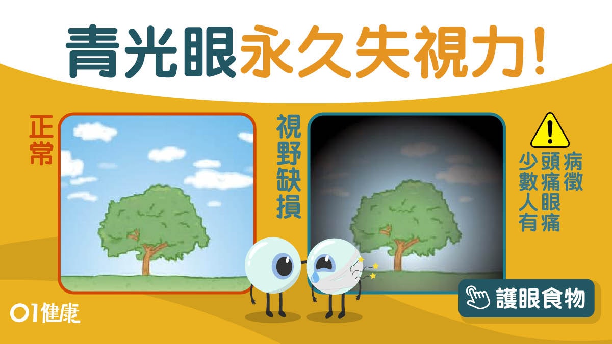 青光眼成因 高血壓糠尿大近視12類人高危視神經持續受損恐失明