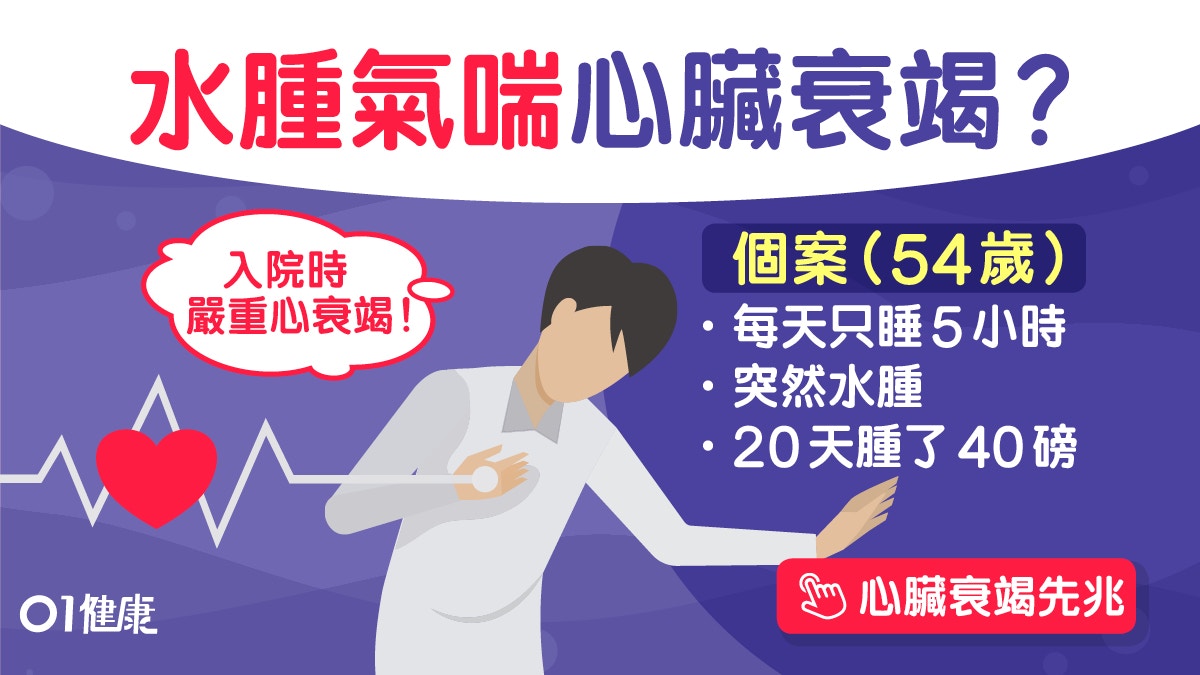 心臟衰竭｜水腫增重20日20公斤心衰竭！失眠平躺氣喘8症狀戒捱夜