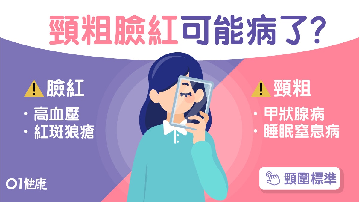 高血壓|臉紅頸粗未必高血壓!糖尿更年期或有呢7種病怎算頸粗? 高血壓|臉紅頸粗未必高血壓!糖尿更年期或有呢7種病怎算頸粗?