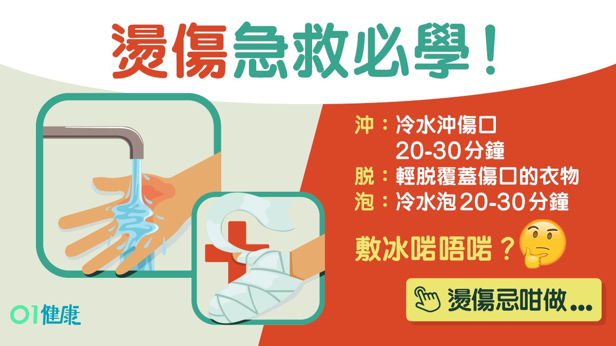 燙傷急救｜滾水燙傷敷冰搽藥膏都係錯！急救5步驟應否即時沖水？