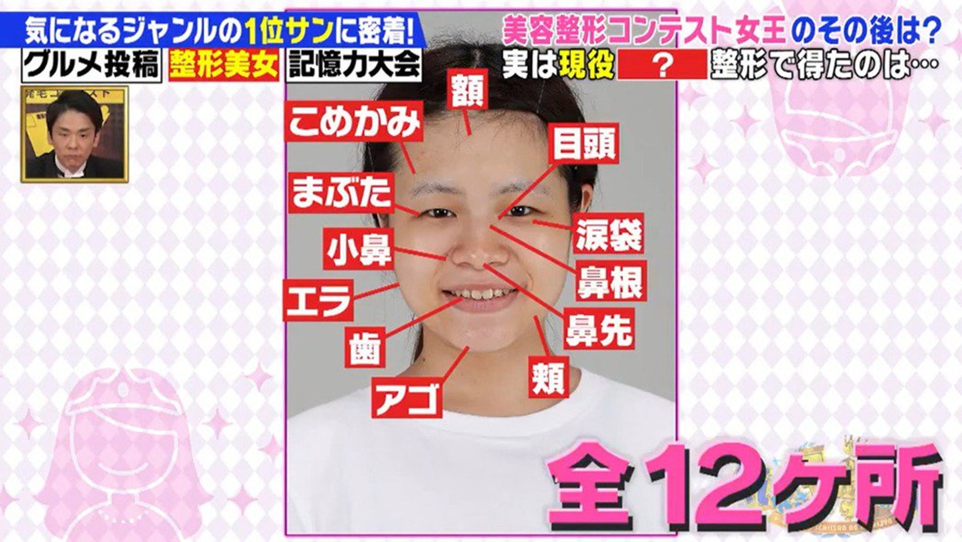 日本女生為成為偶像而整容(《気になる1位サンの日常》截圖) 日本女生為成為偶像而整容(《気になる1位サンの日常》截圖)