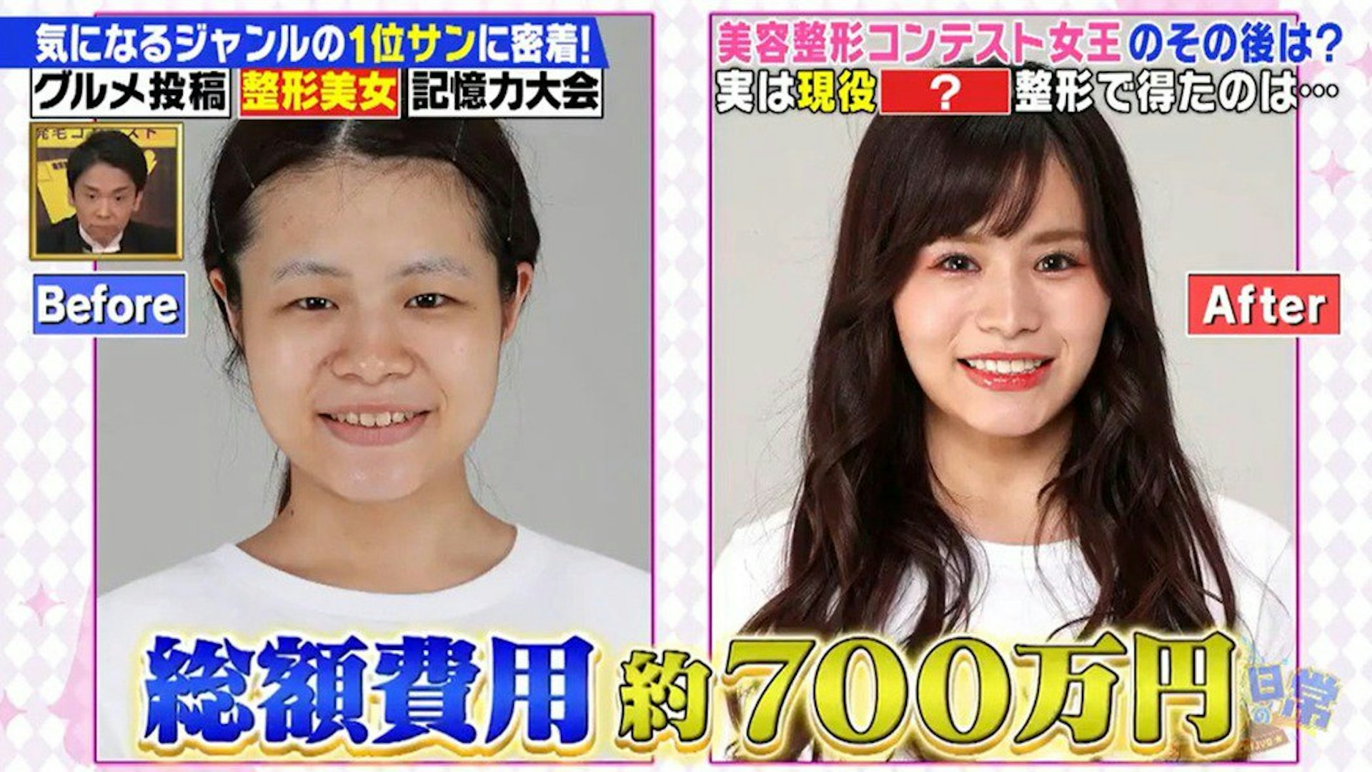 日本女生為成為偶像而整容(《気になる1位サンの日常》截圖) 日本女生為成為偶像而整容(《気になる1位サンの日常》截圖)