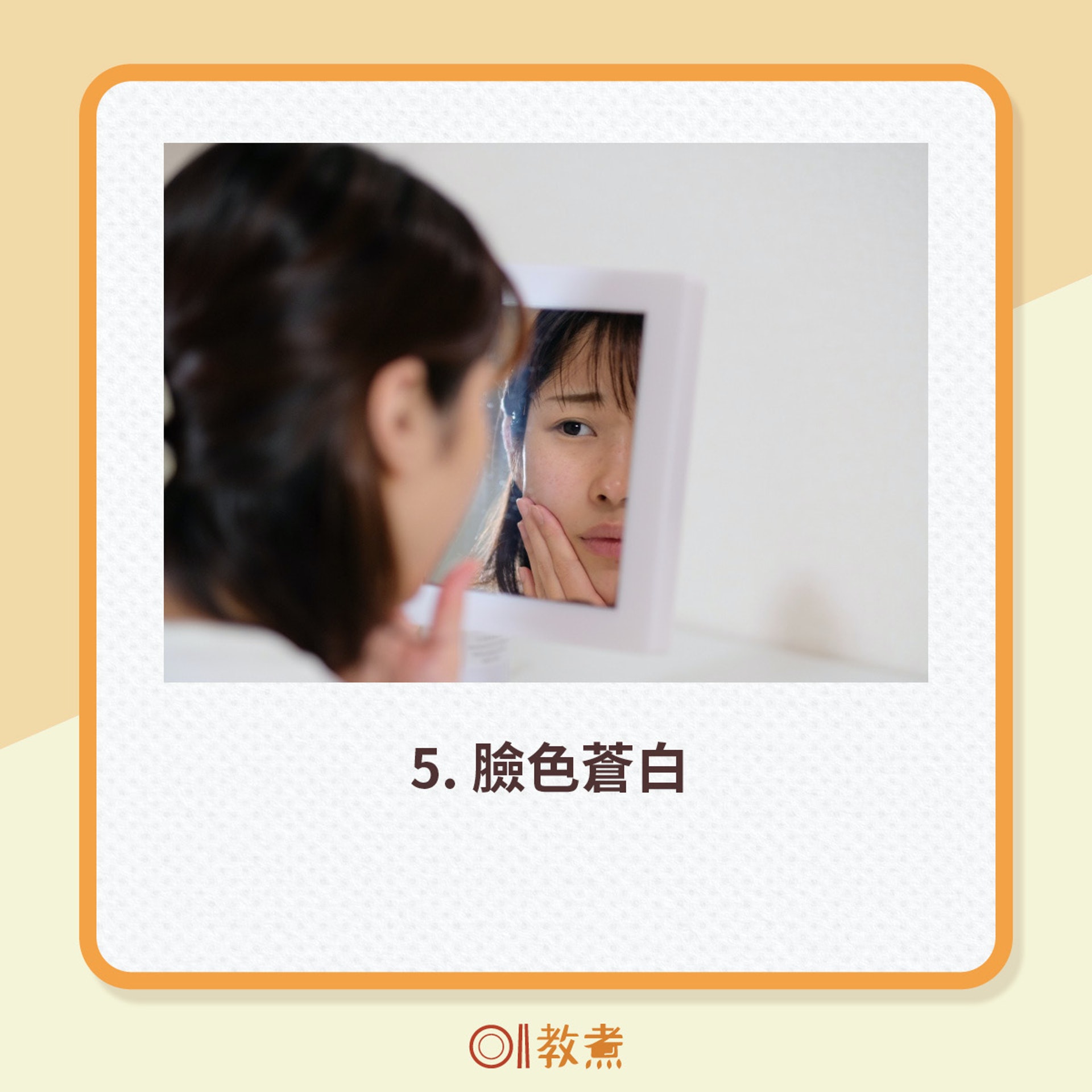 缺乏鐵質症狀(GettyImages) 缺乏鐵質症狀(GettyImages)