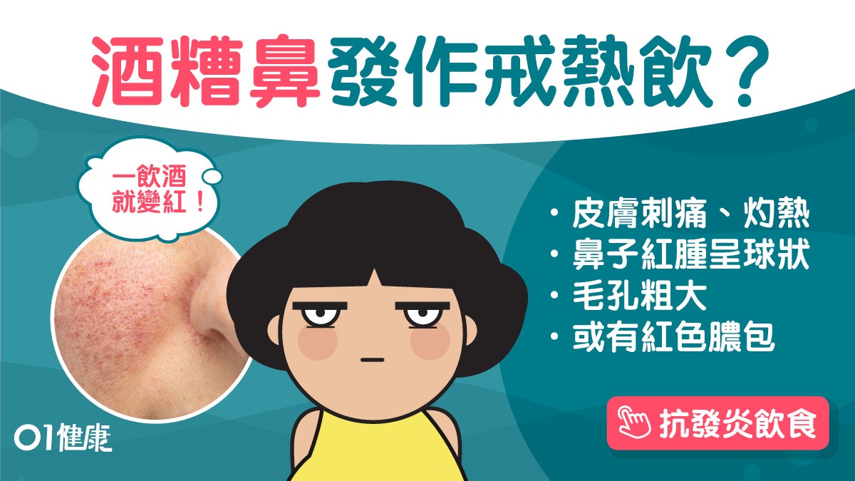 玫瑰痤瘡|毛孔大眼皮突酒糟皮膚炎7症狀 按摩保濕橄欖油紓緩7招 玫瑰痤瘡|毛孔大眼皮突酒糟皮膚炎7症狀 按摩保濕橄欖油紓緩7招