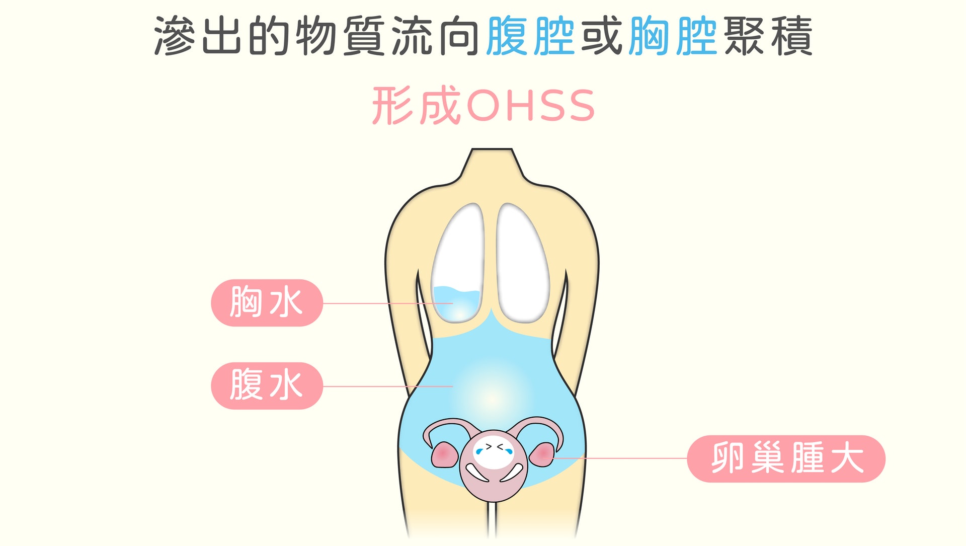(圖片:e-stork) (圖片:e-stork)
