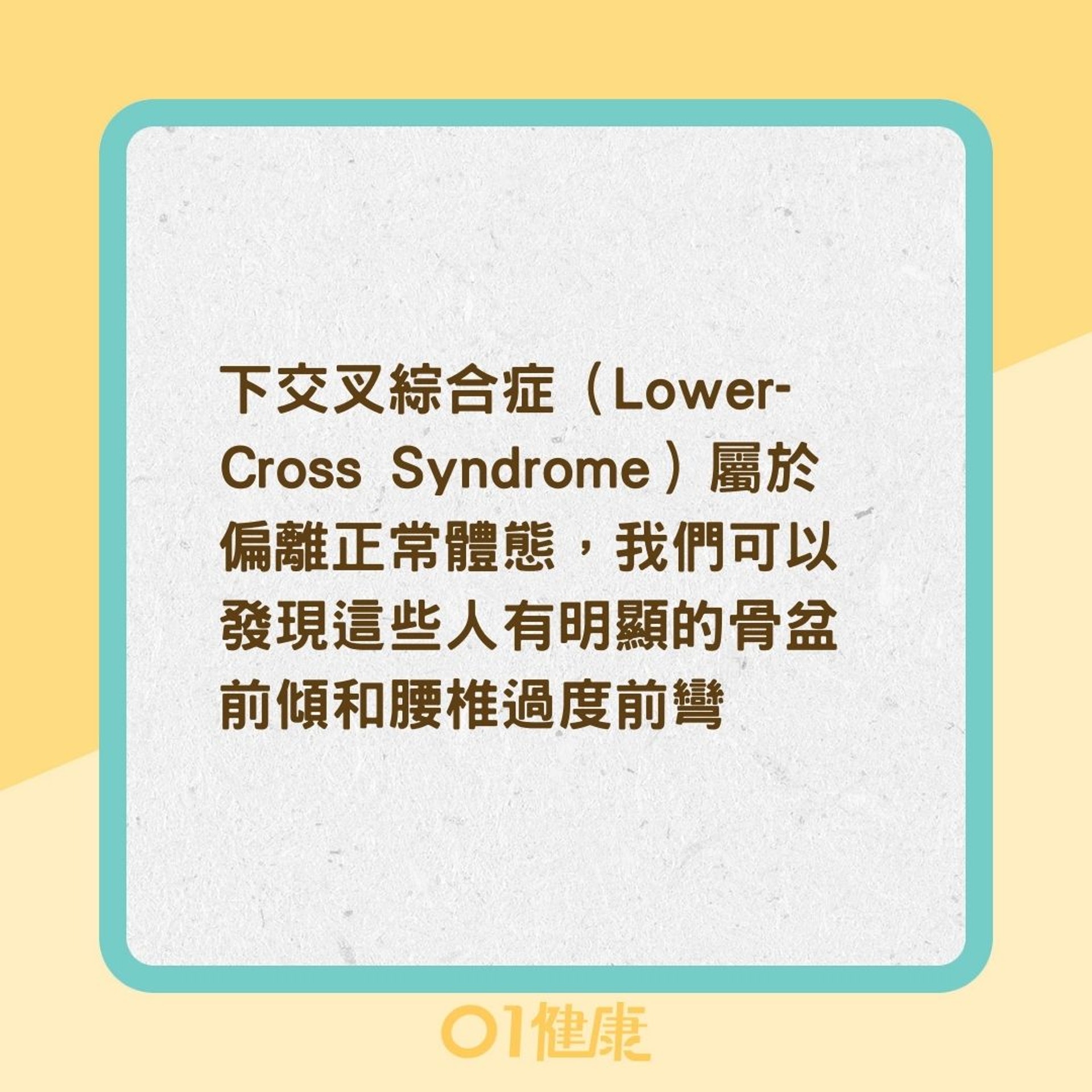 什麼是下交叉綜合症?(01製圖) 什麼是下交叉綜合症?(01製圖)