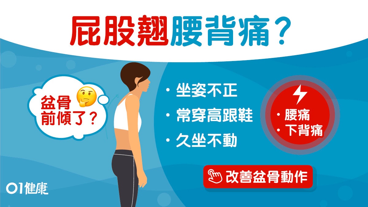 腰痛|屁股翹或下交叉症候群 久坐姿勢錯易骨盆前傾4式防腰膝痛 腰痛|屁股翹或下交叉症候群 久坐姿勢錯易骨盆前傾4式防腰膝痛