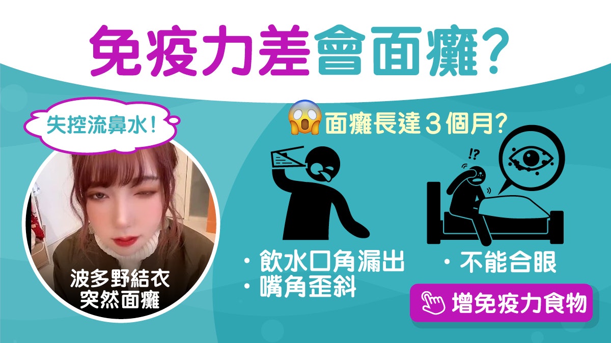 面癱|波多野結衣左眼不能合面癱4症狀 補充4營養素蛋蒜增免疫力 面癱|波多野結衣左眼不能合面癱4症狀 補充4營養素蛋蒜增免疫力