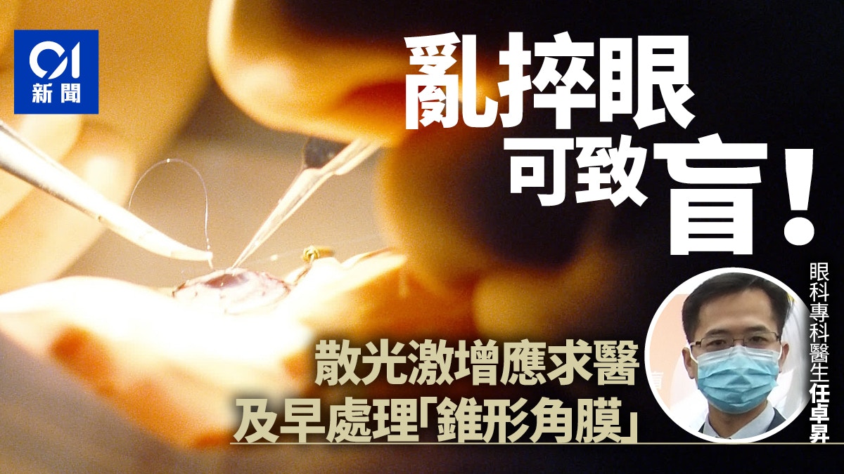 四成港人有捽眼習慣 眼科醫生:可致錐形角膜 嚴重可致盲