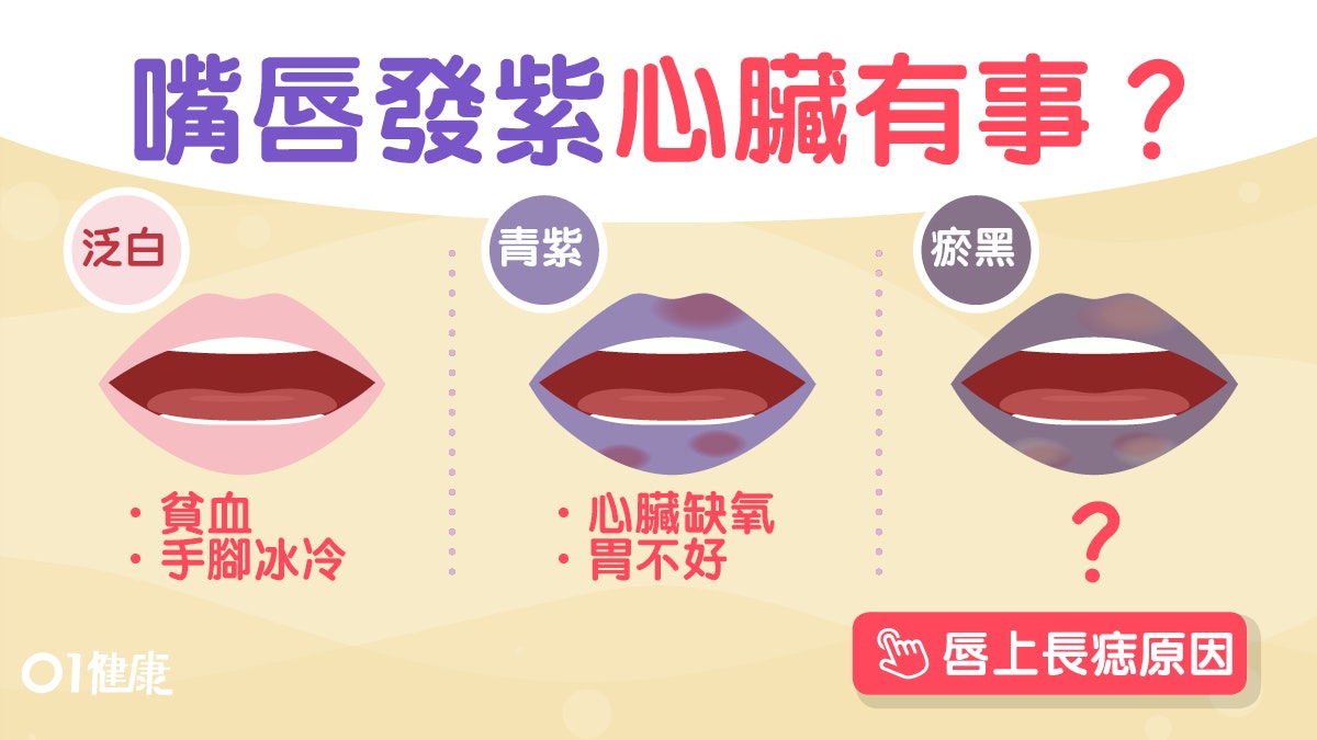 心臟衰竭 氣喘腳腫一日體重增重3公斤 這3種唇色反映貧血缺氧 香港01 健康 心臟衰竭 氣喘腳腫一日體重增重3公斤 這3種唇色反映貧血缺氧 香港01 健康